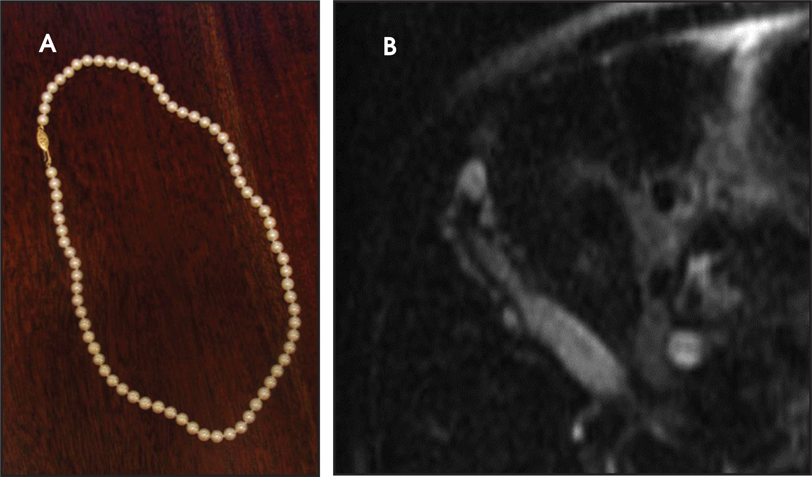 FIGURE 32.