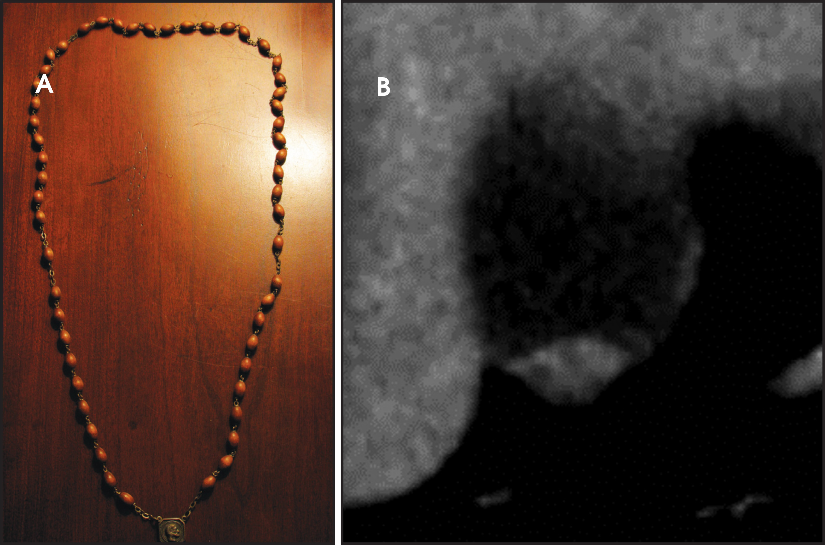 FIGURE 33.