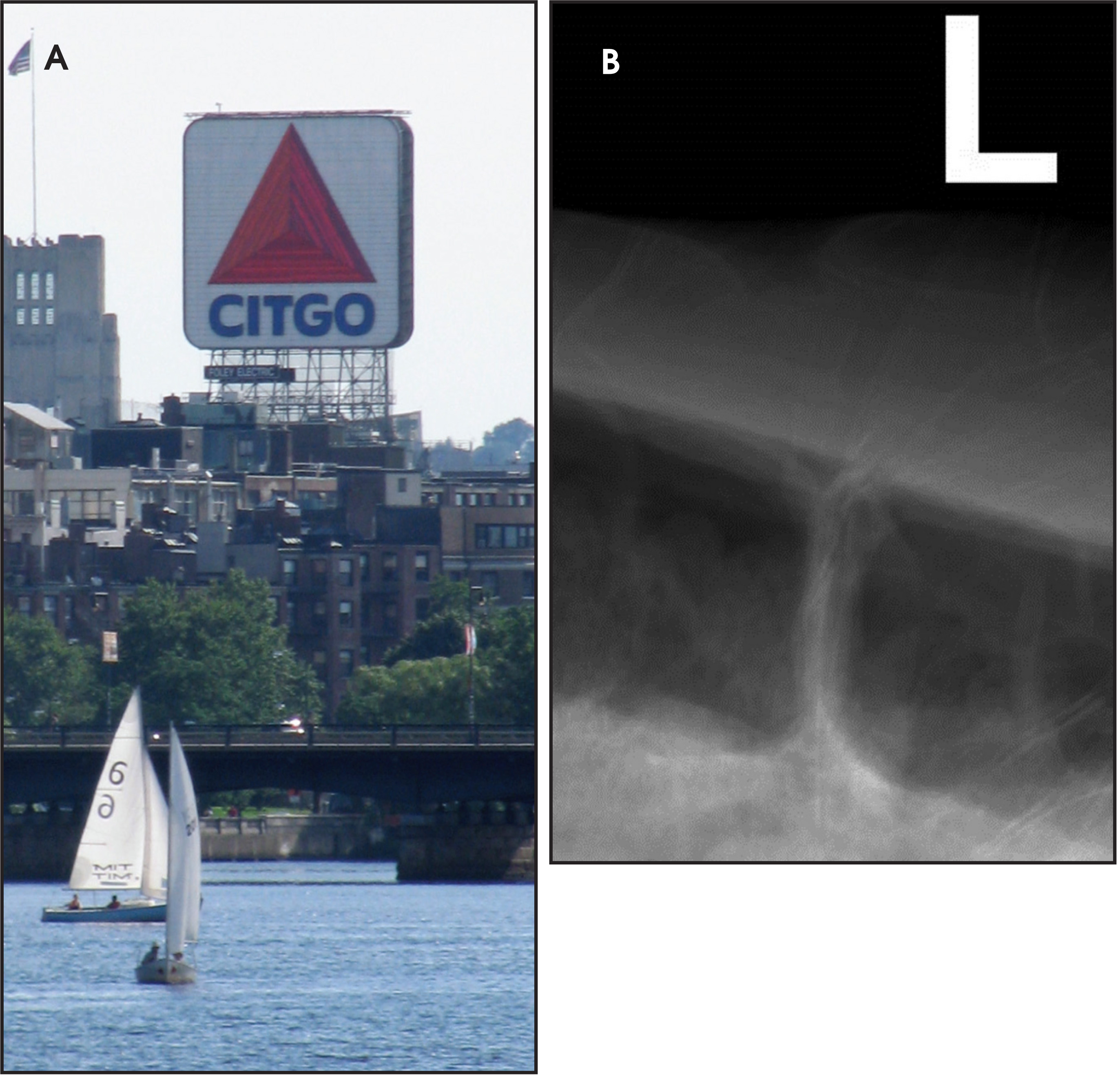 FIGURE 35.