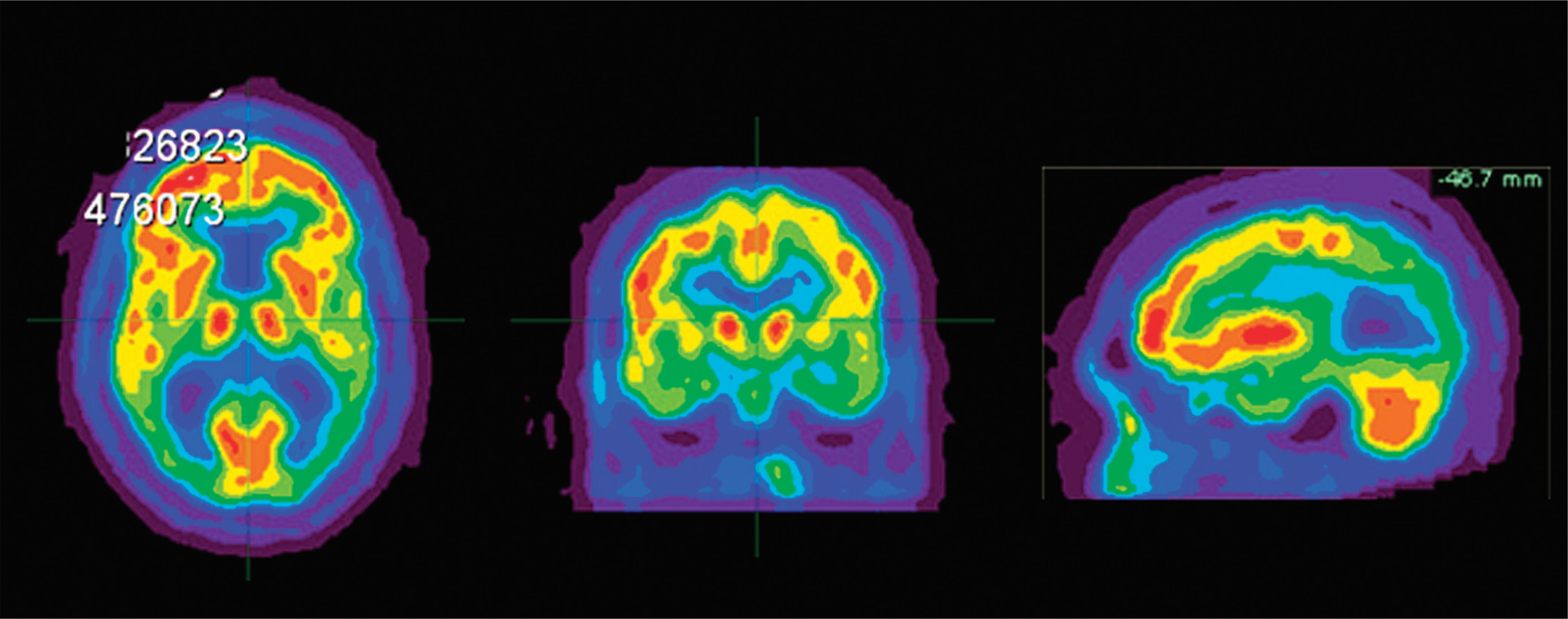 FIGURE 4.
