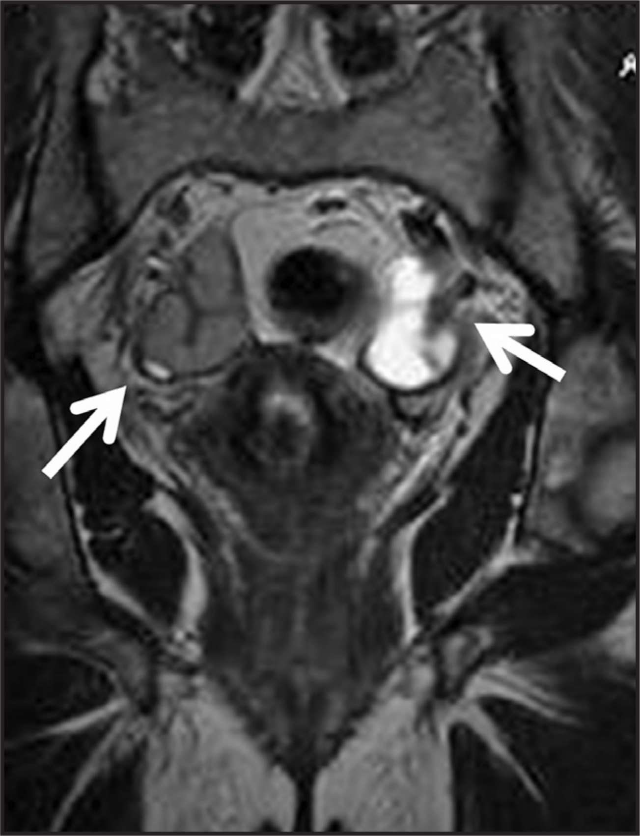 FIGURE 11.