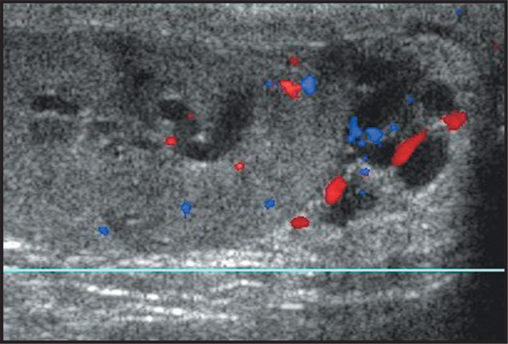 FIGURE 3.