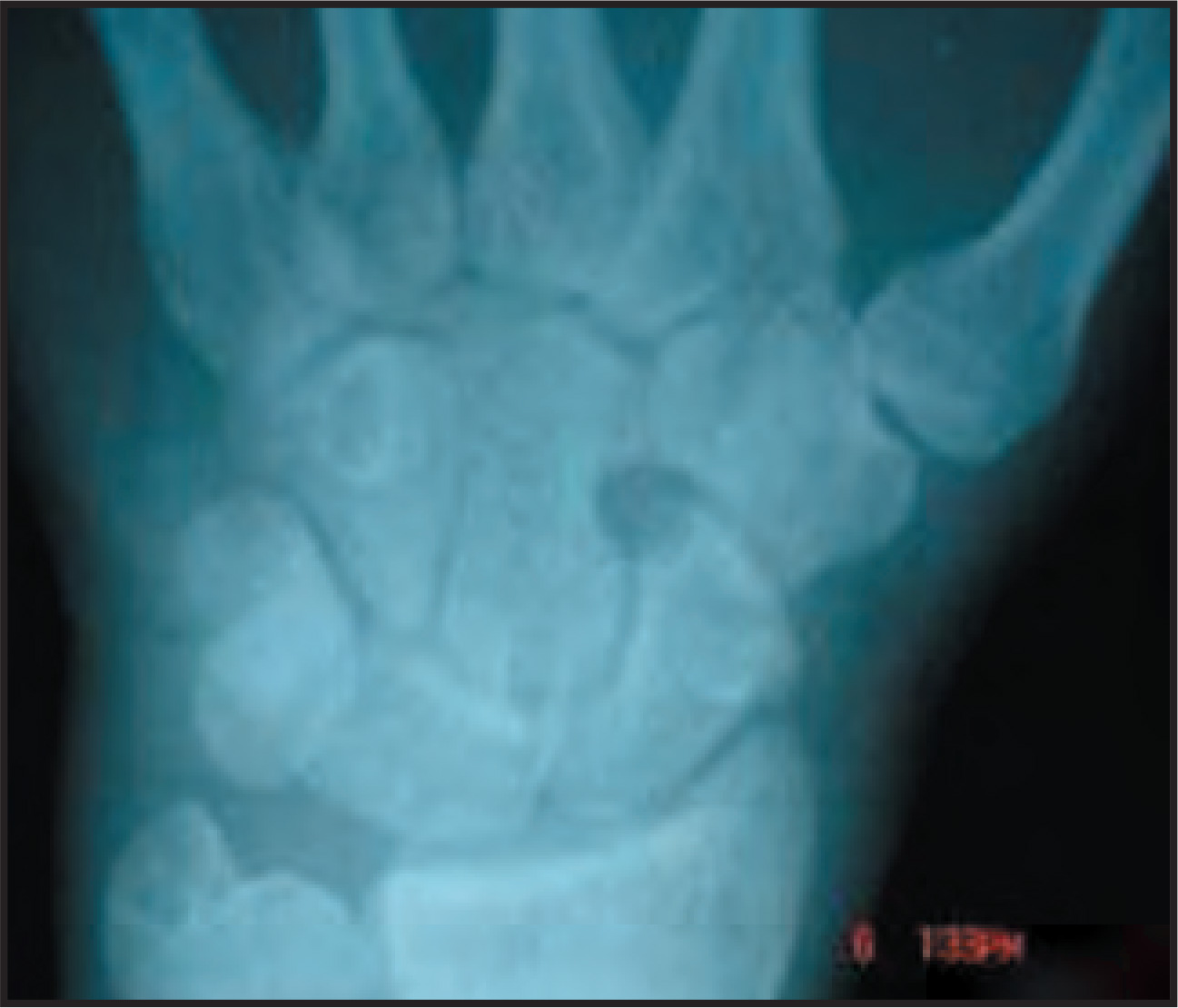 FIGURE 2.