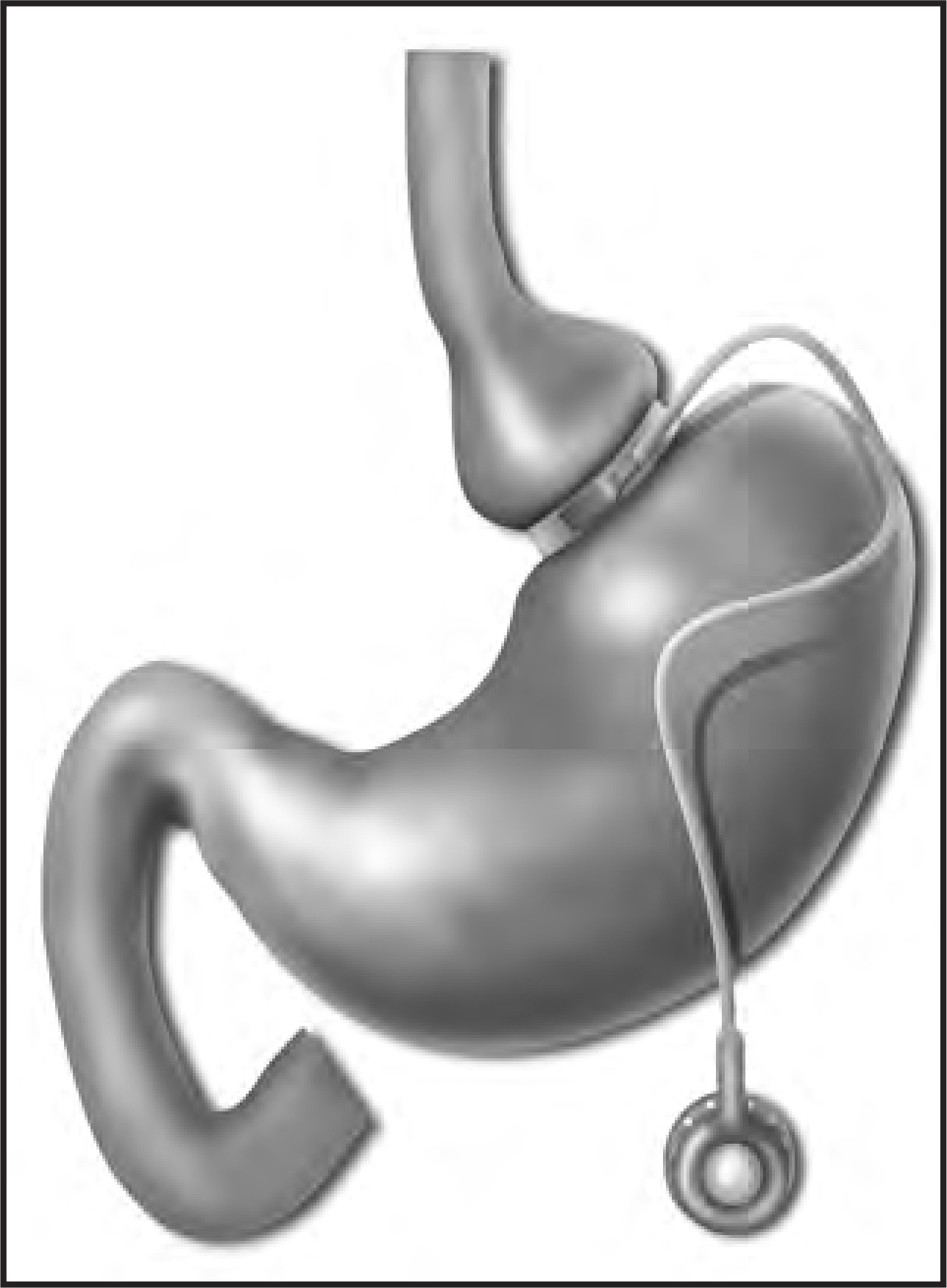FIGURE 9.