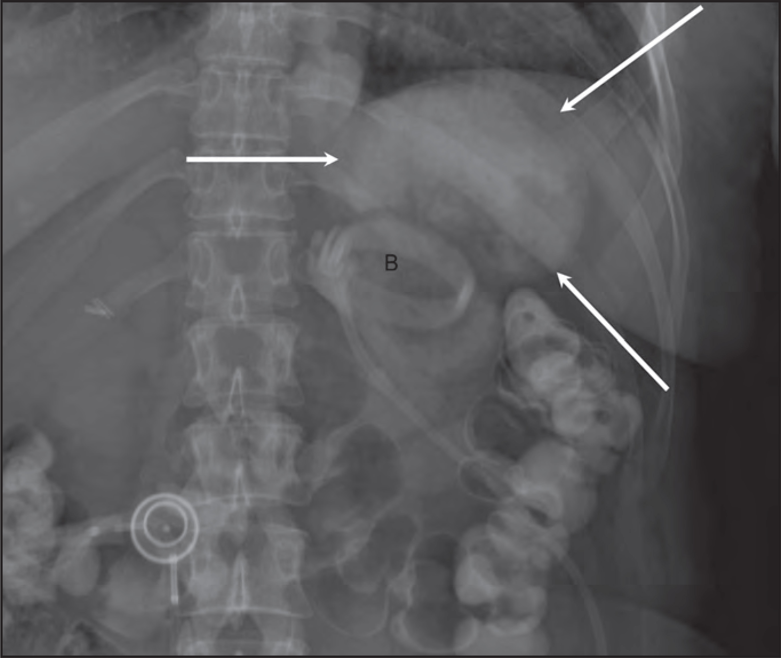 FIGURE 11.