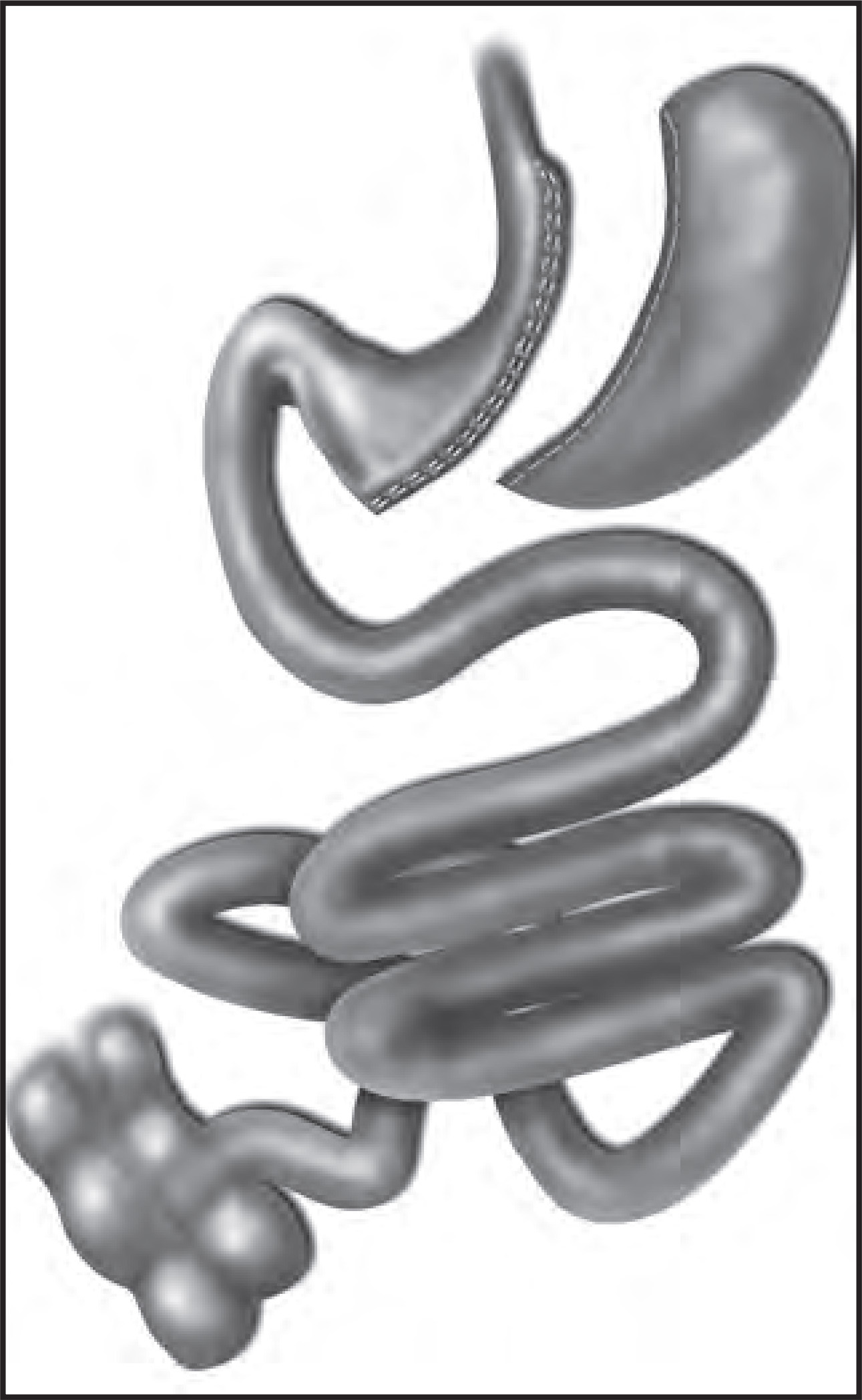 FIGURE 13.