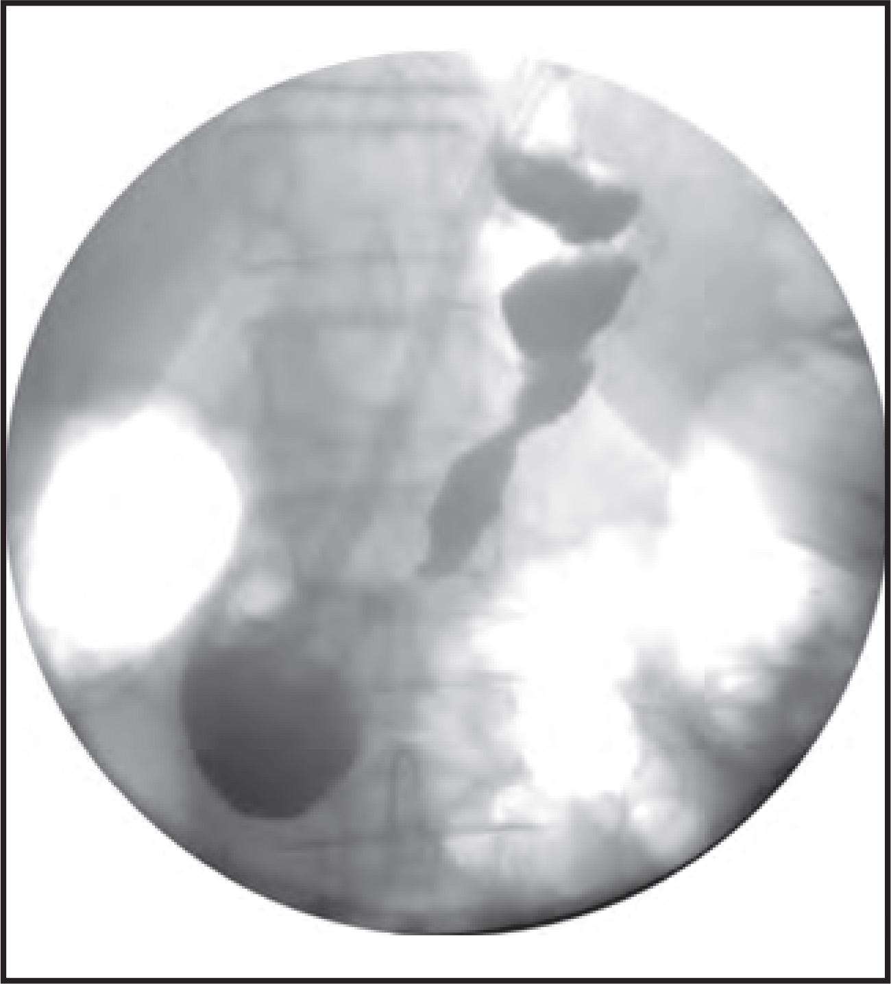 FIGURE 14.