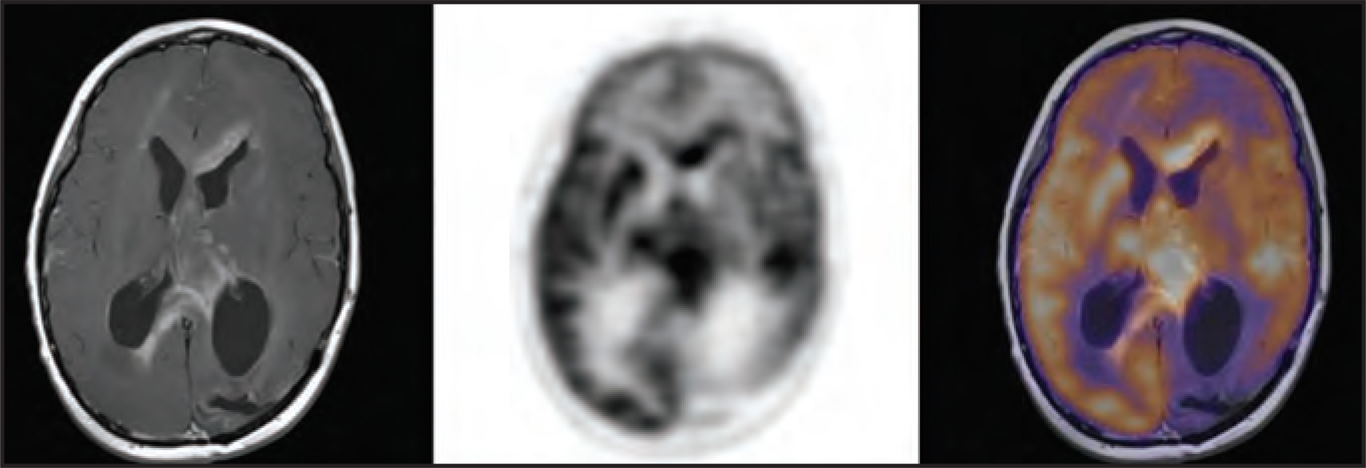 FIGURE 11.