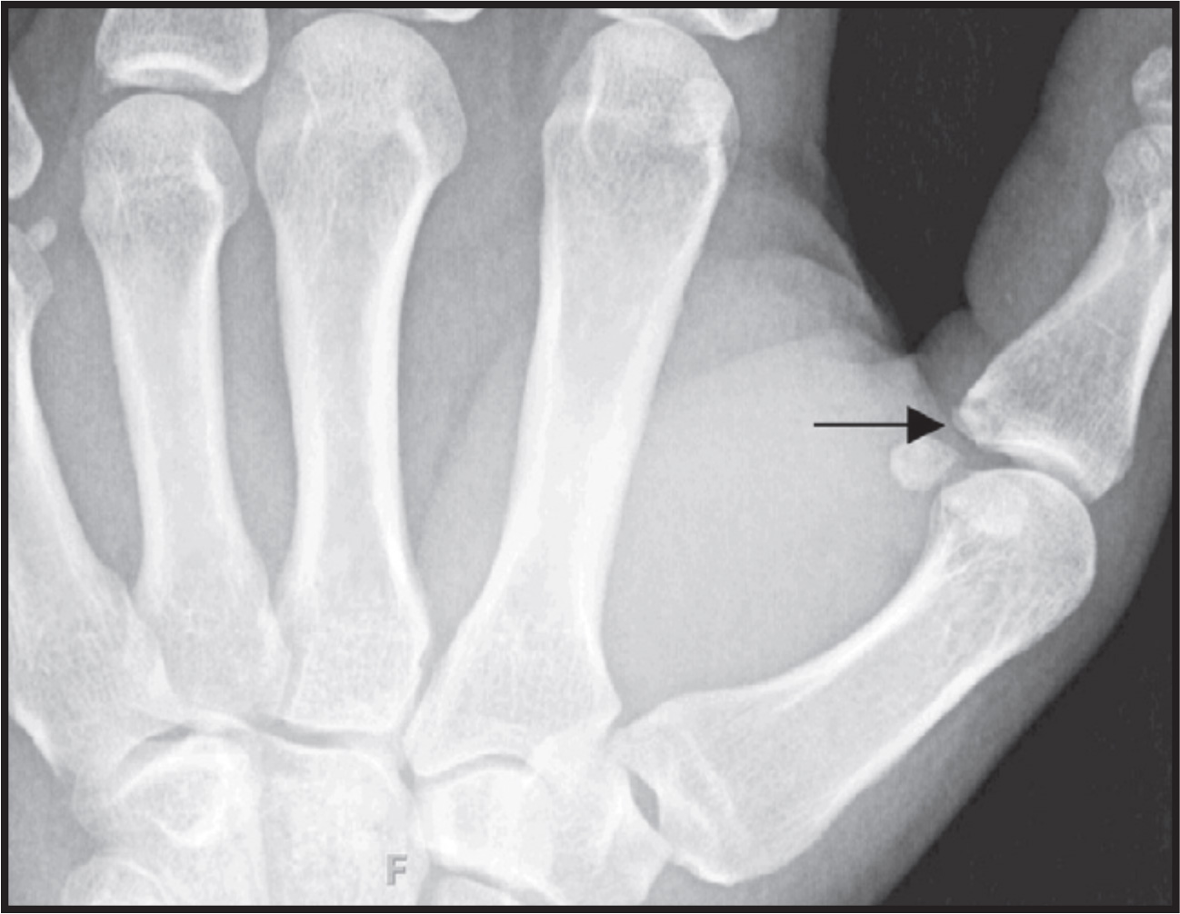 FIGURE 1.