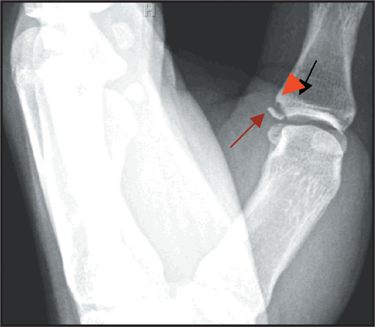 FIGURE 2.
