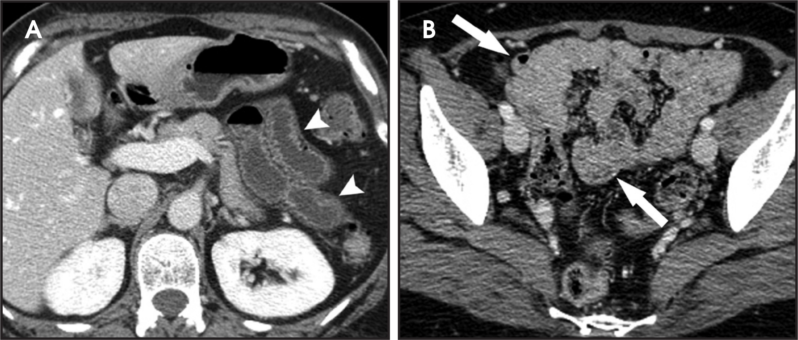 FIGURE 11.