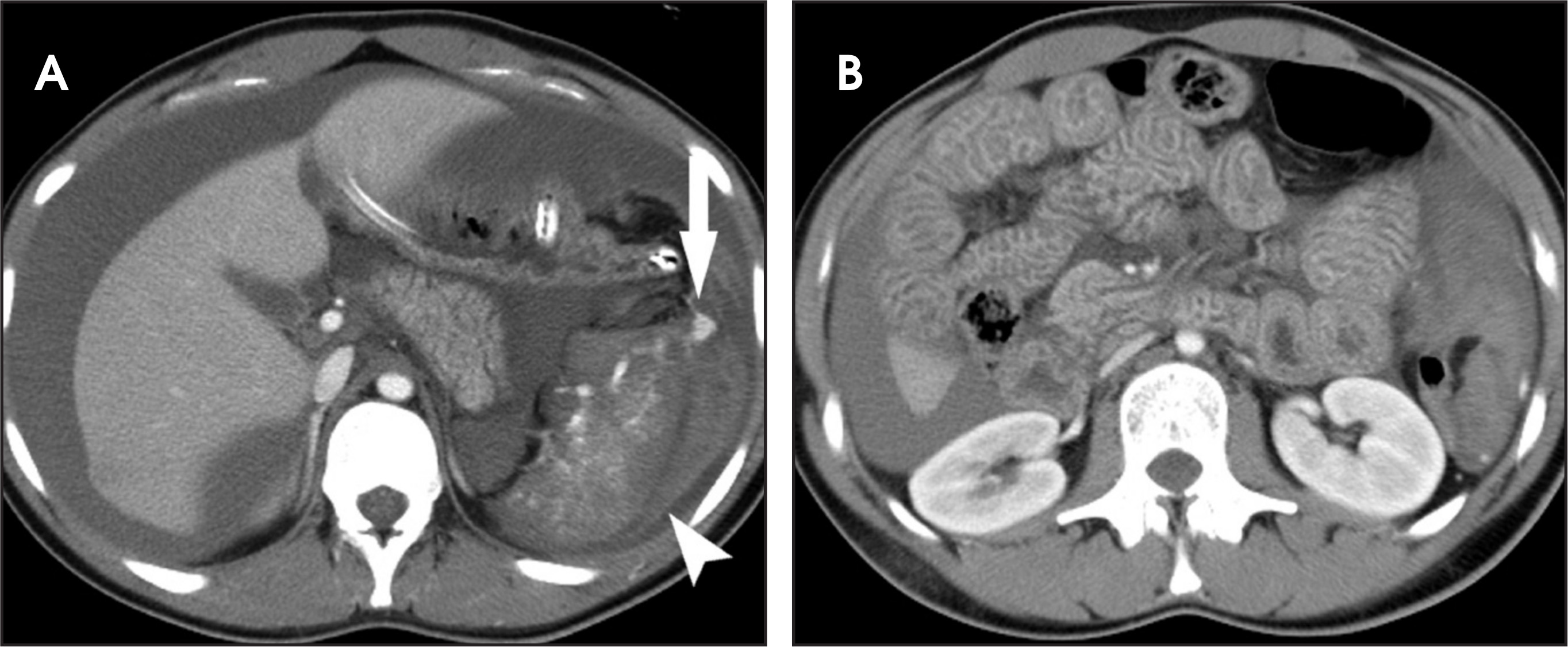 FIGURE 13.