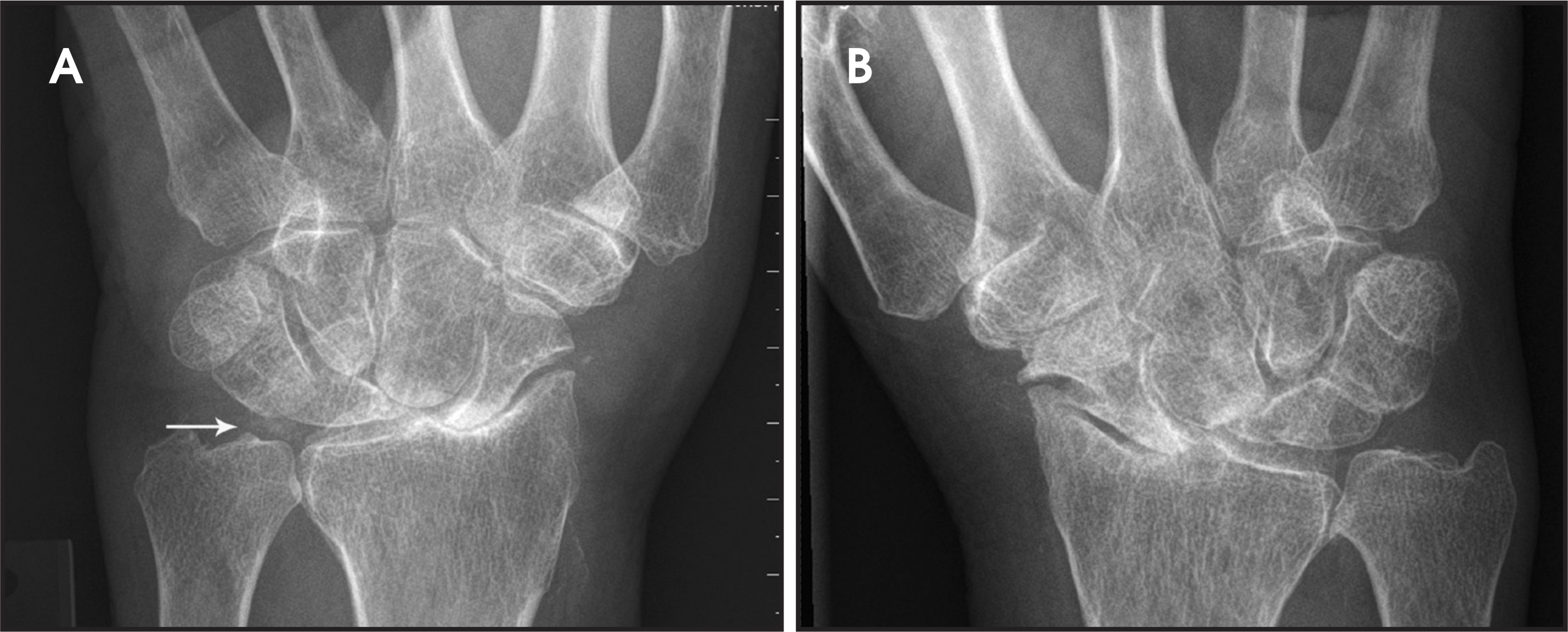FIGURE 4.