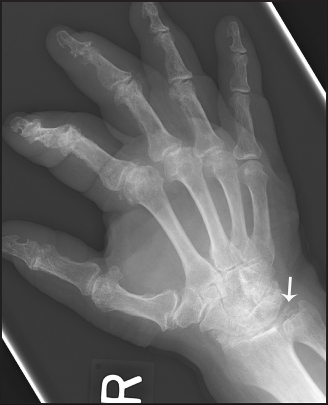 FIGURE 6.