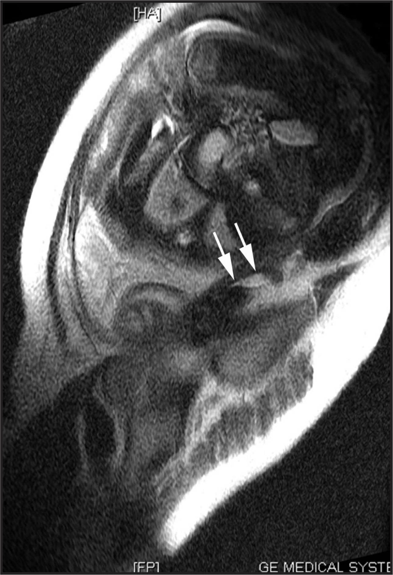 FIGURE 16.