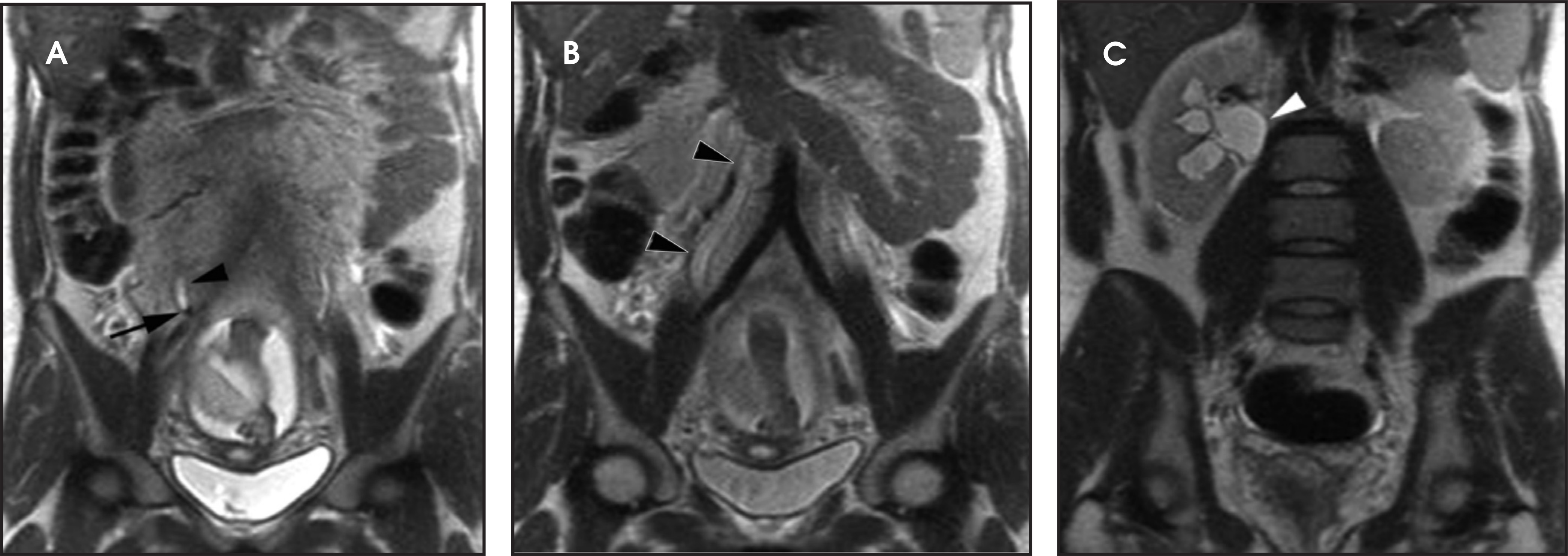 FIGURE 17.