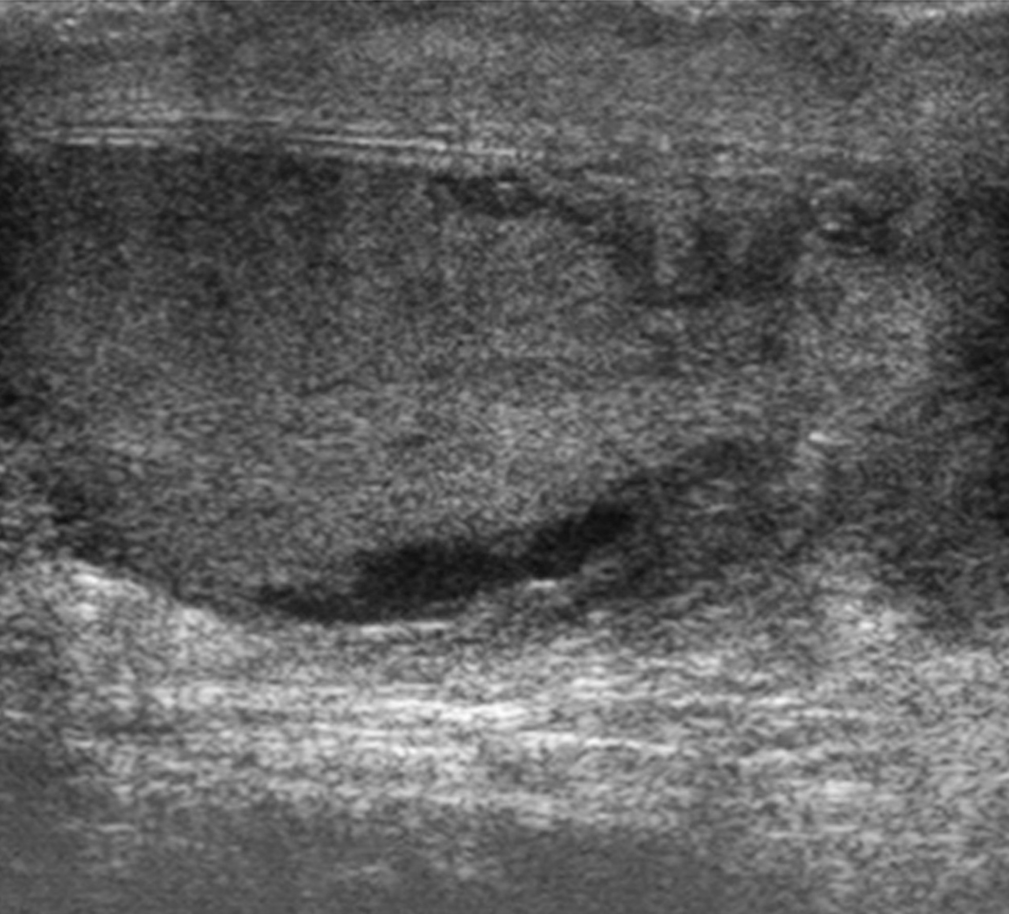 FIGURE 11.