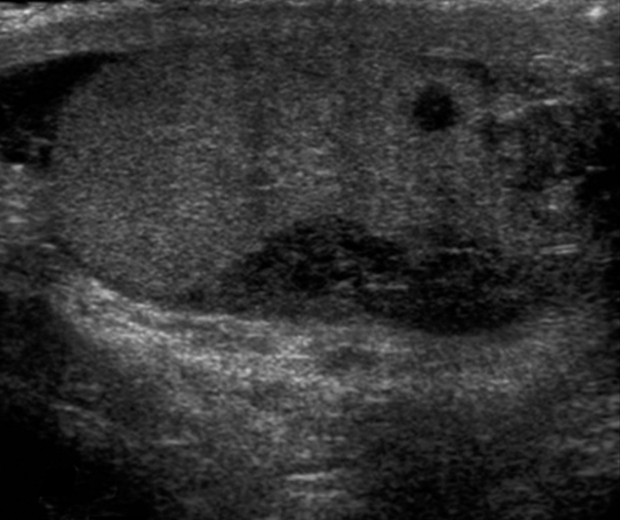 FIGURE 12.