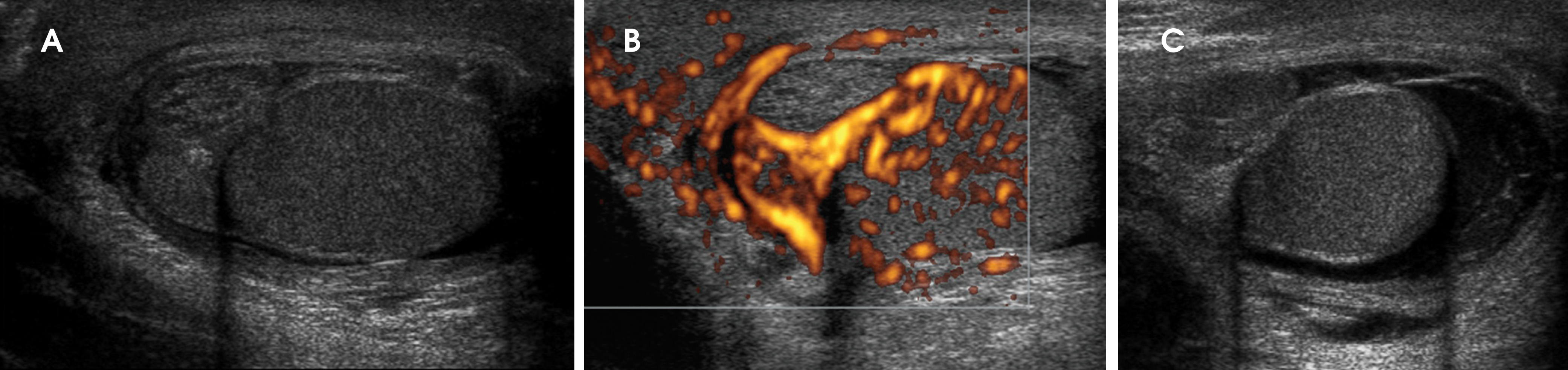 FIGURE 14.