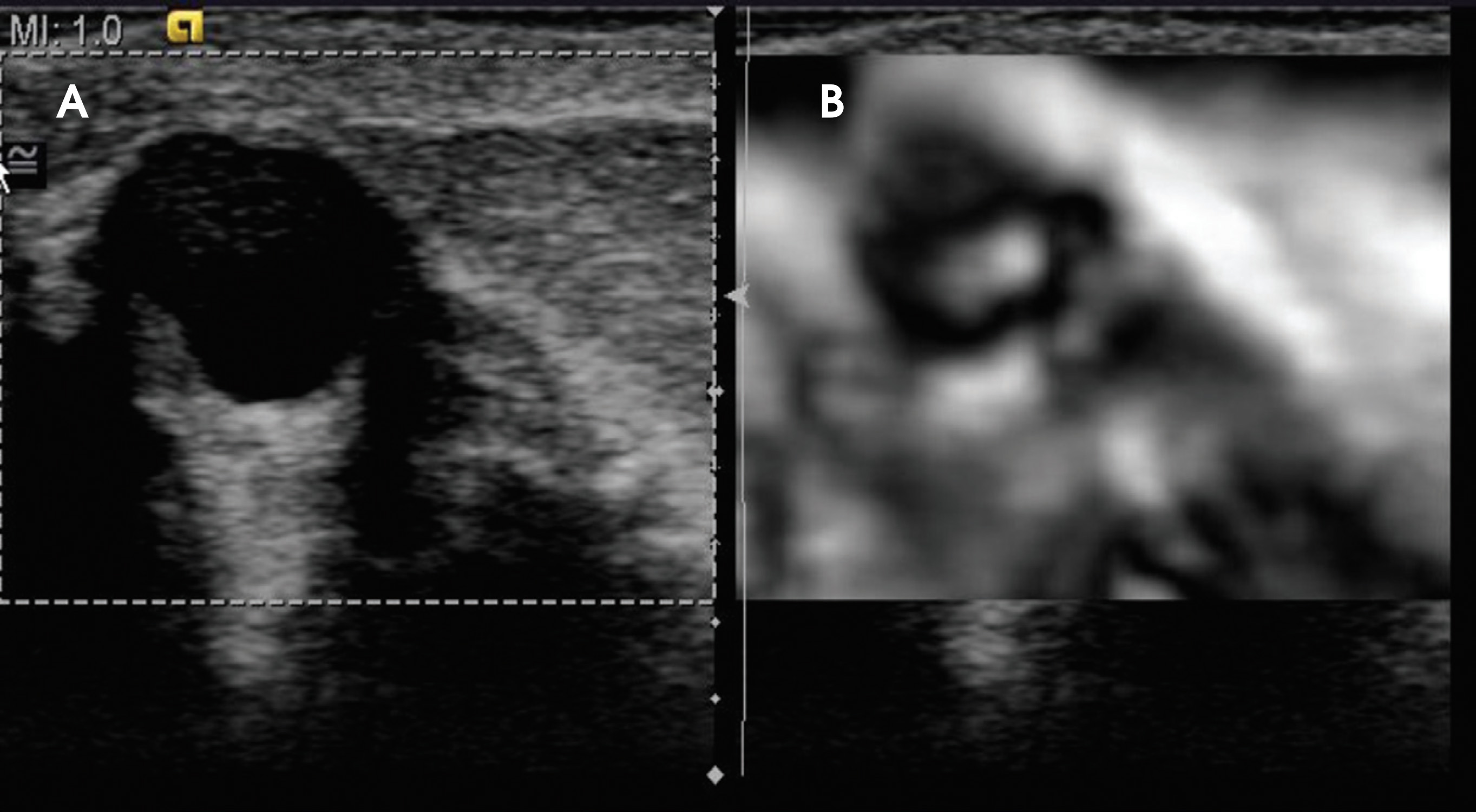 FIGURE 4.