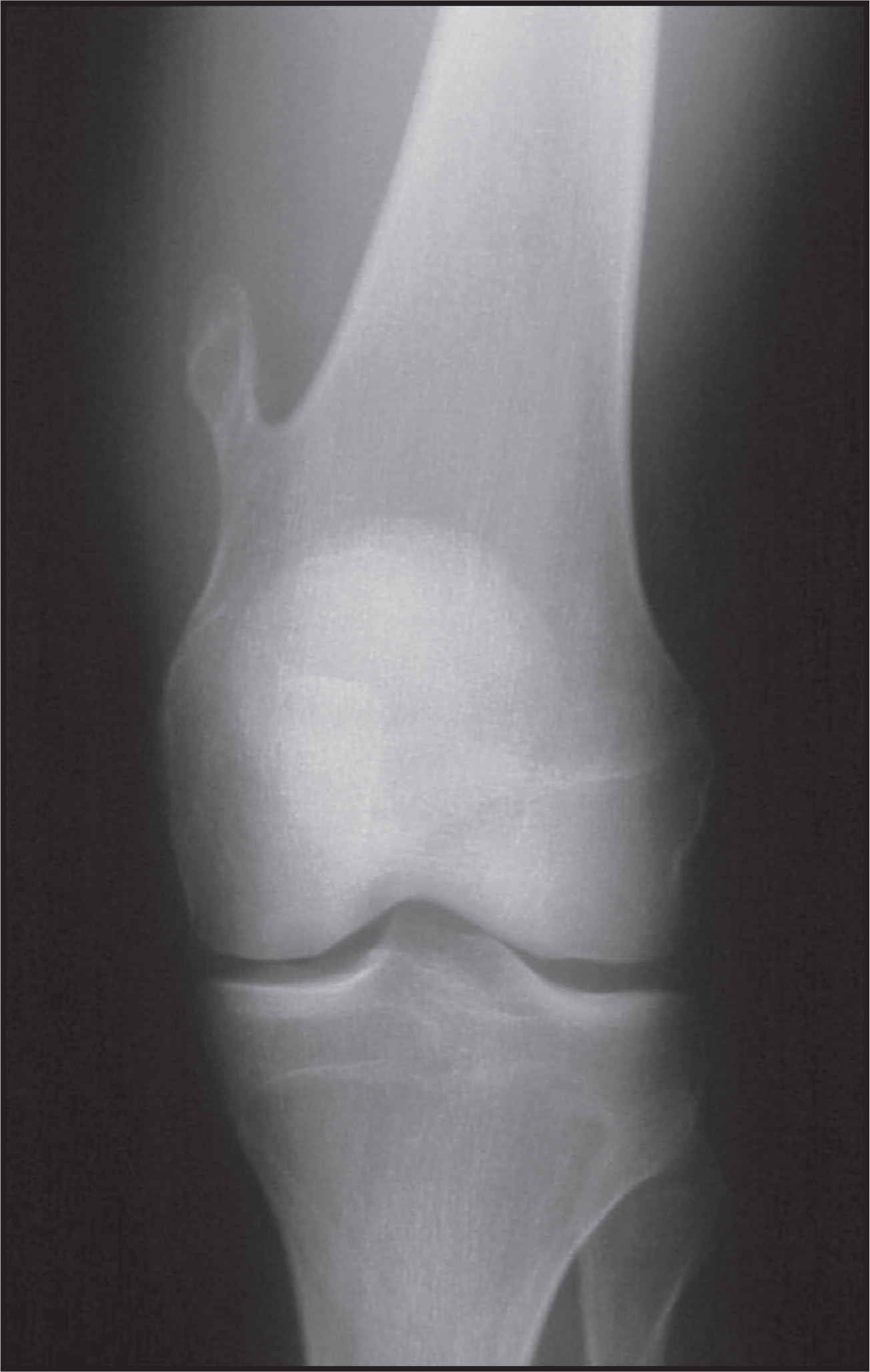 FIGURE 11.