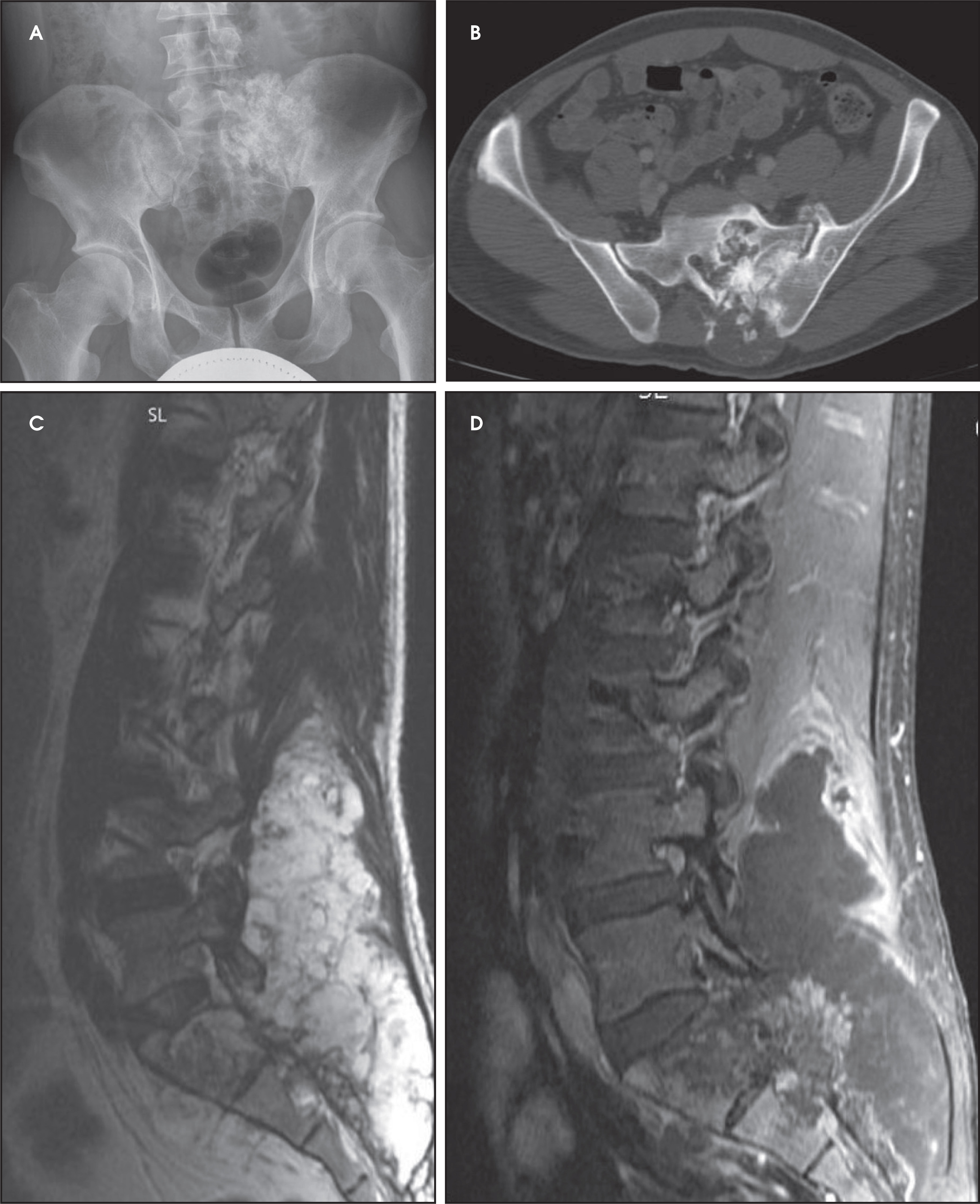 FIGURE 14.