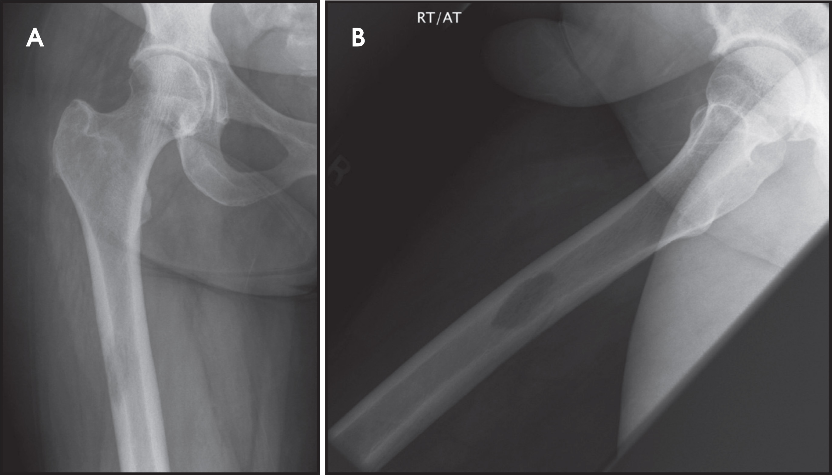 FIGURE 17.