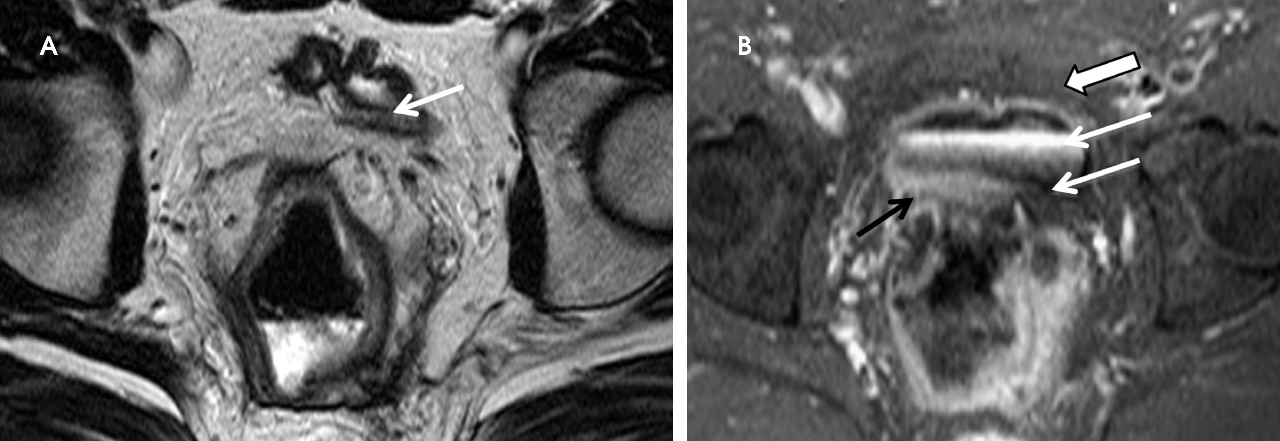 FIGURE 11.