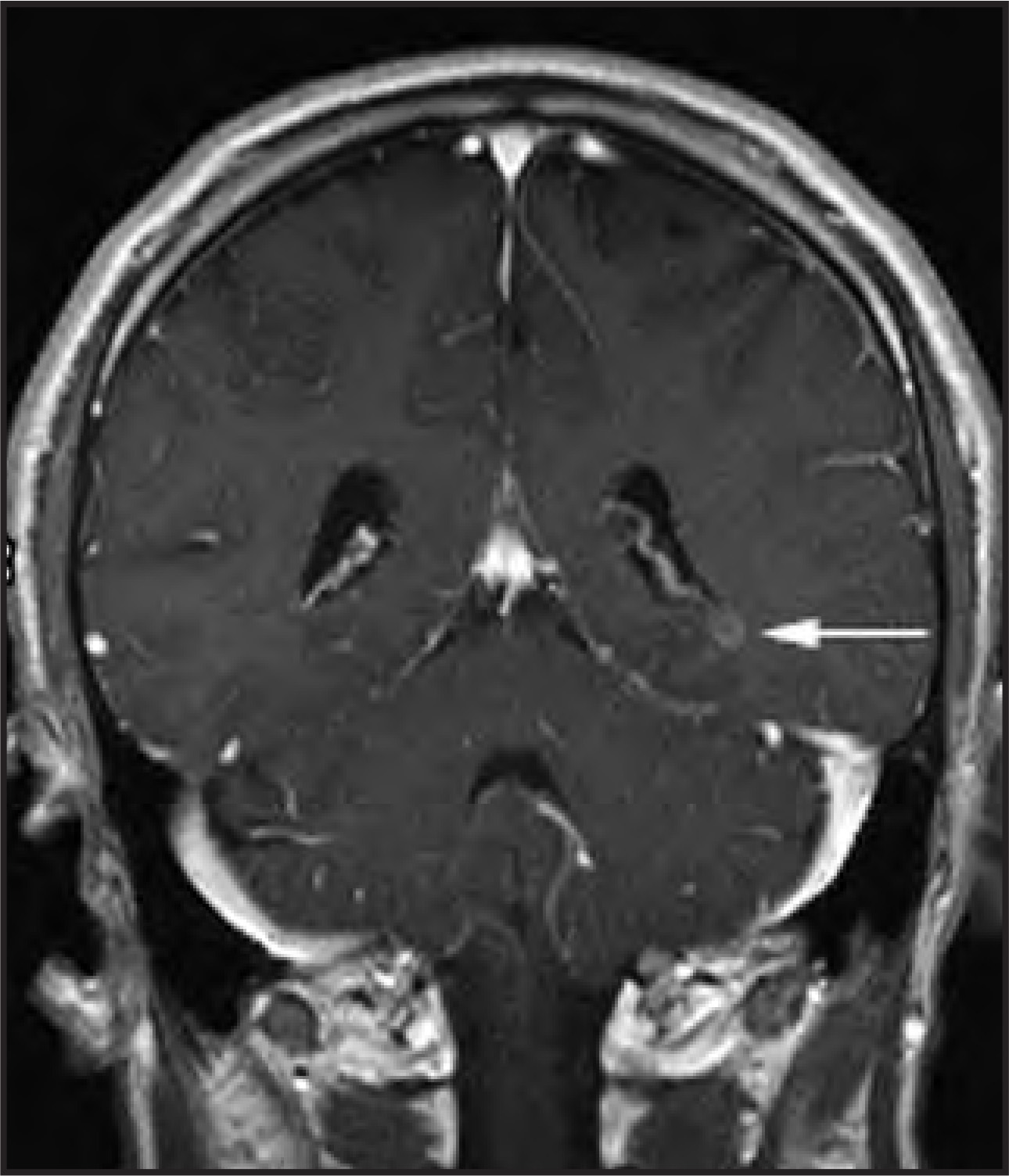 Figure 11.