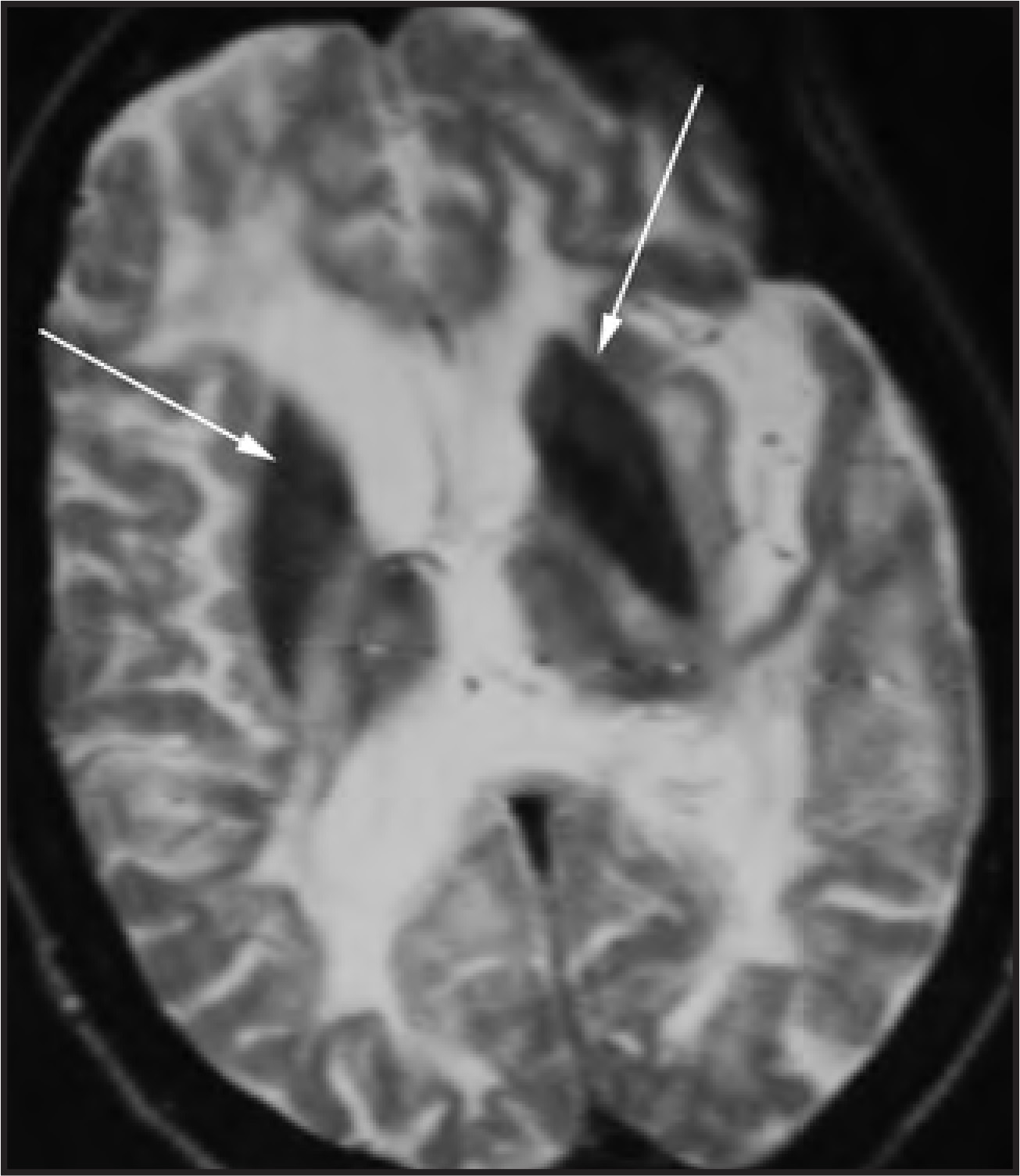 Figure 12.