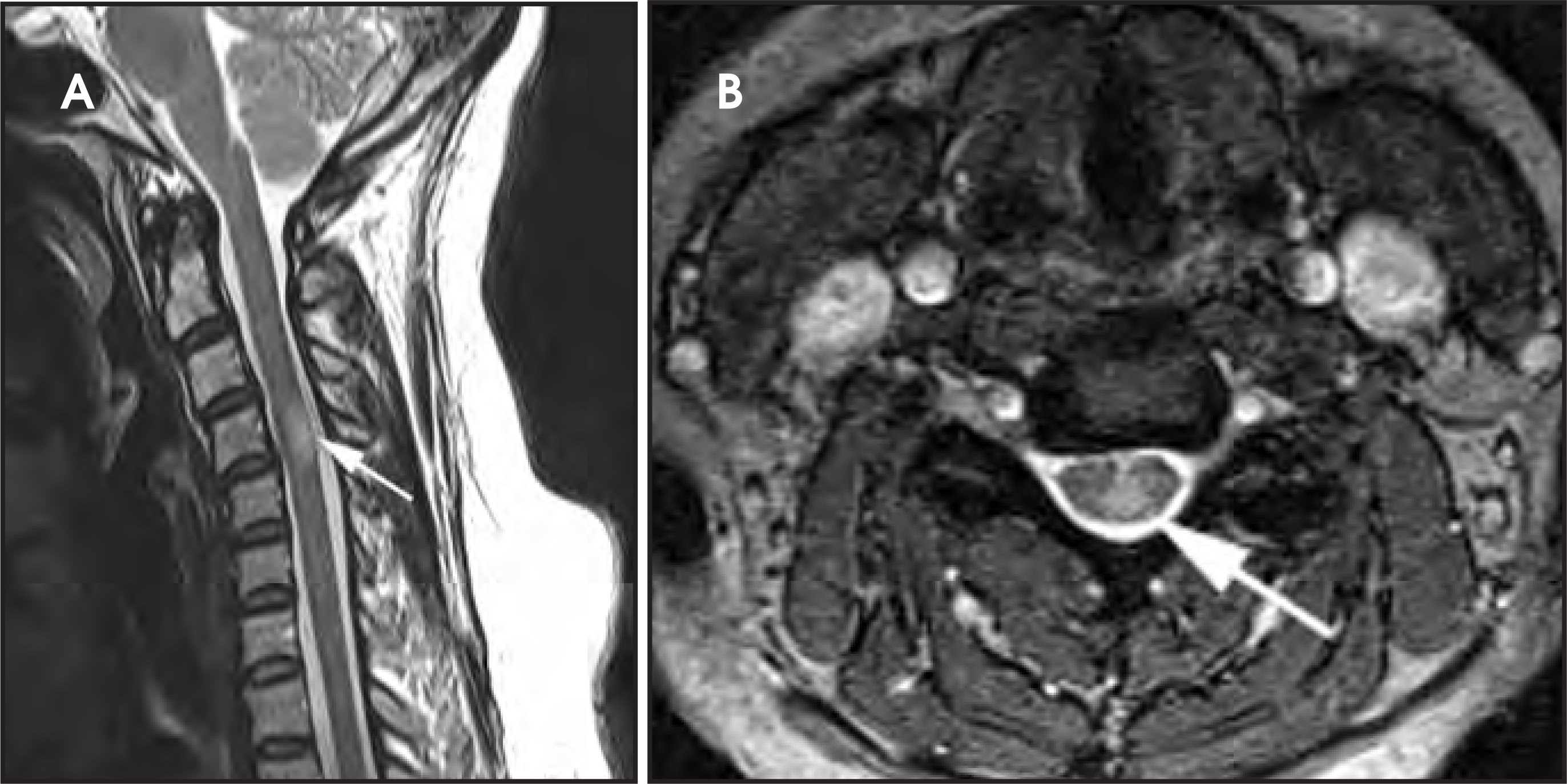 Figure 14.