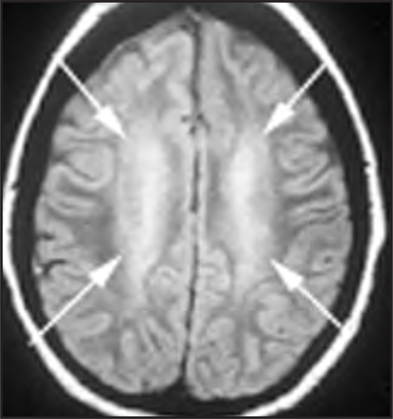 Figure 15.