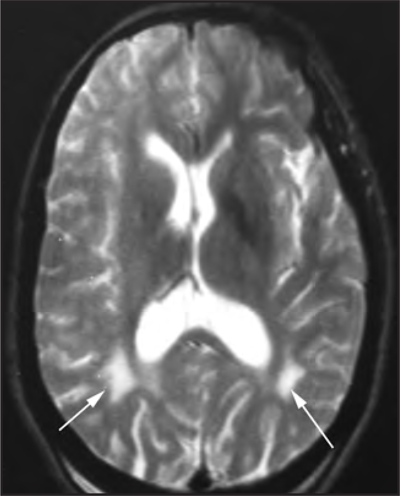 Figure 16.