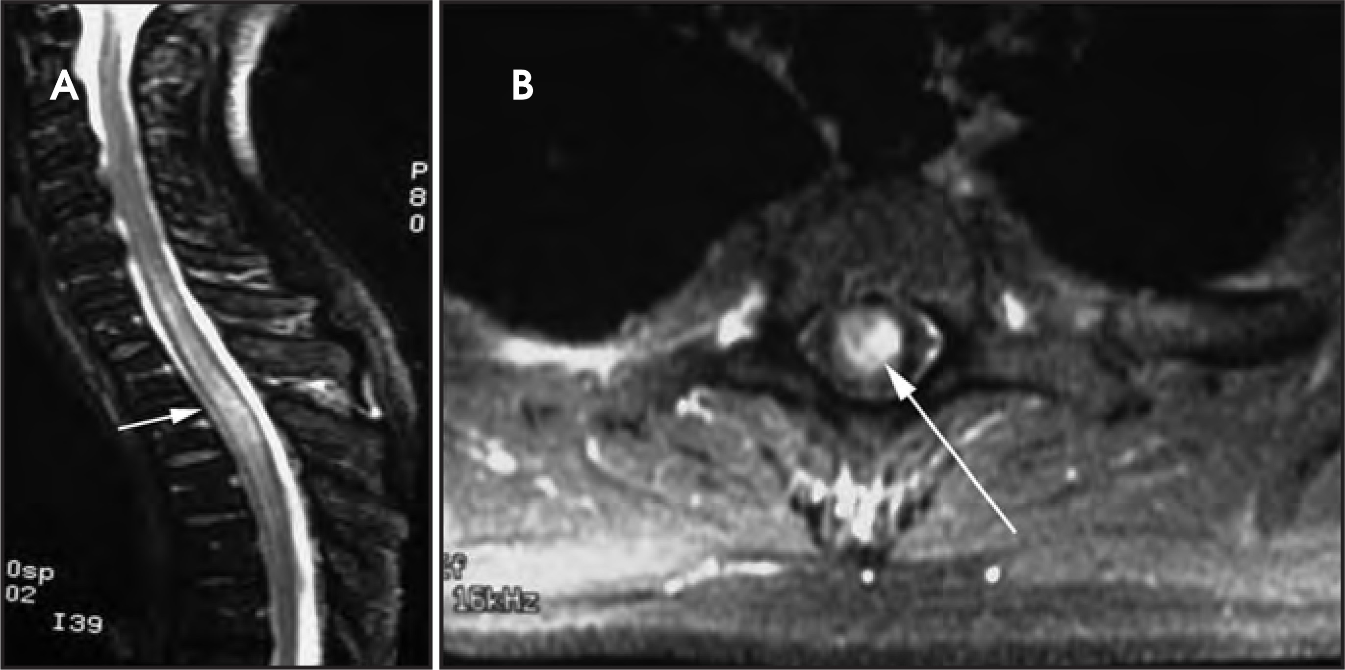 Figure 18.