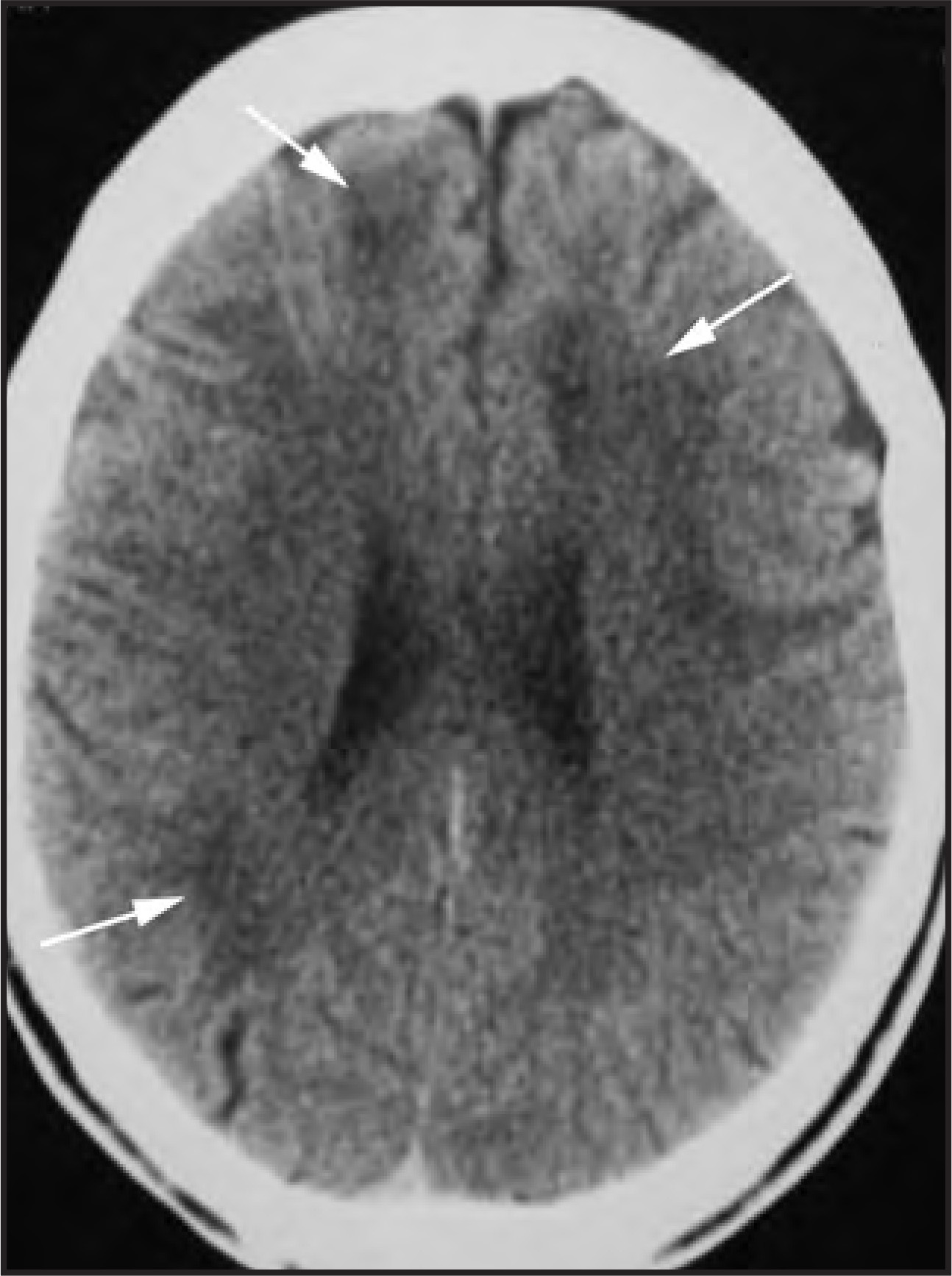 Figure 21.