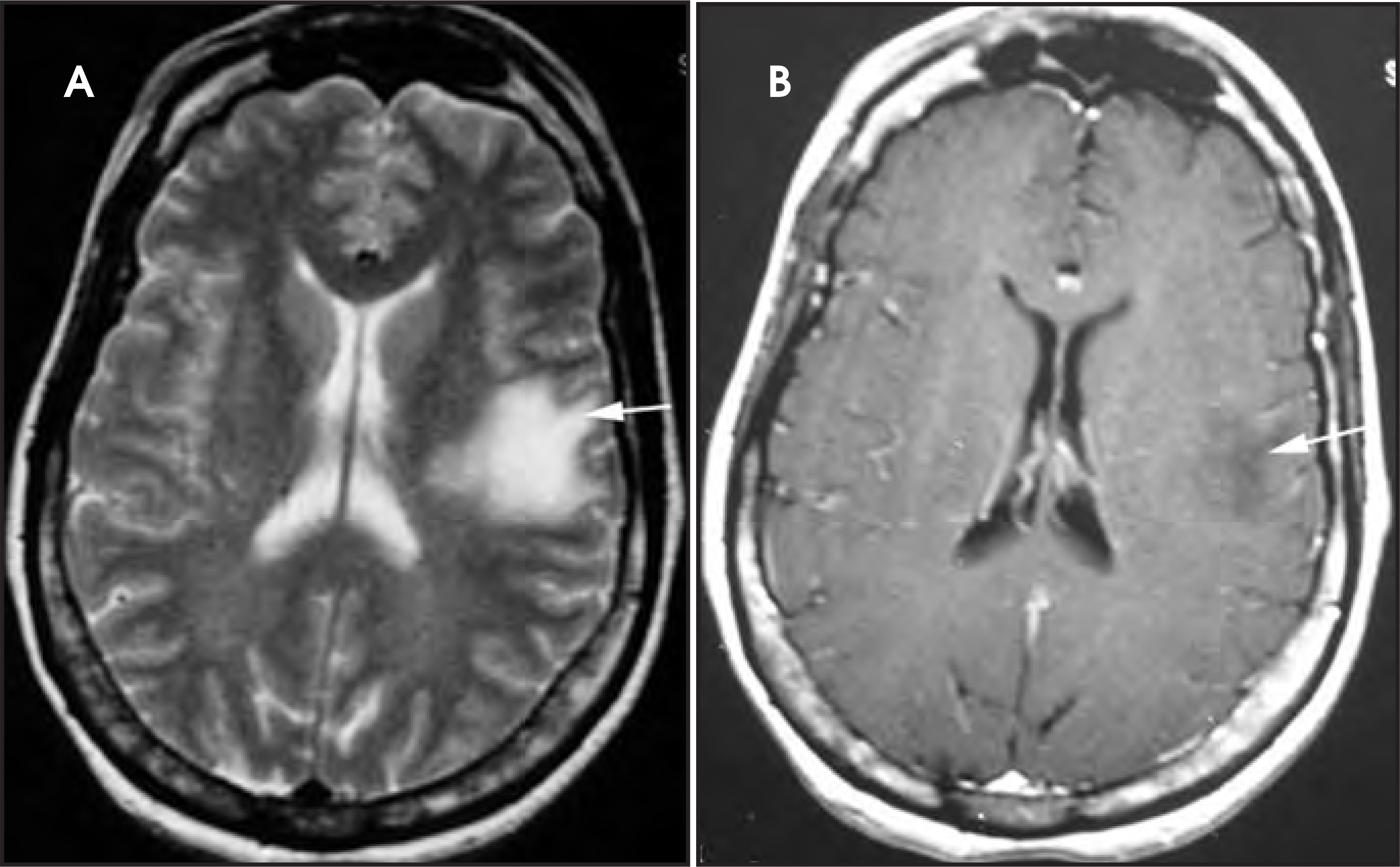 Figure 22.