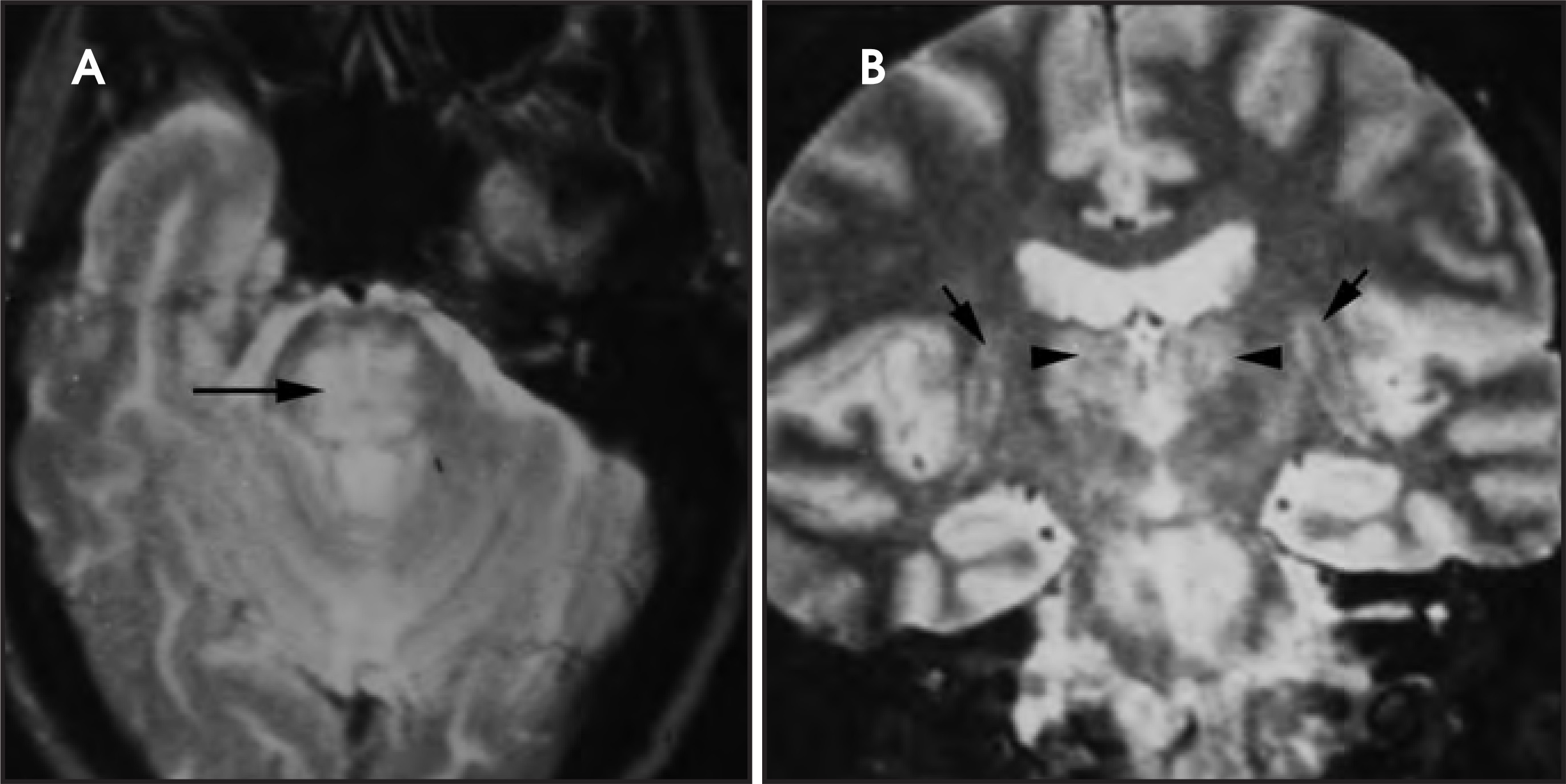 Figure 29.