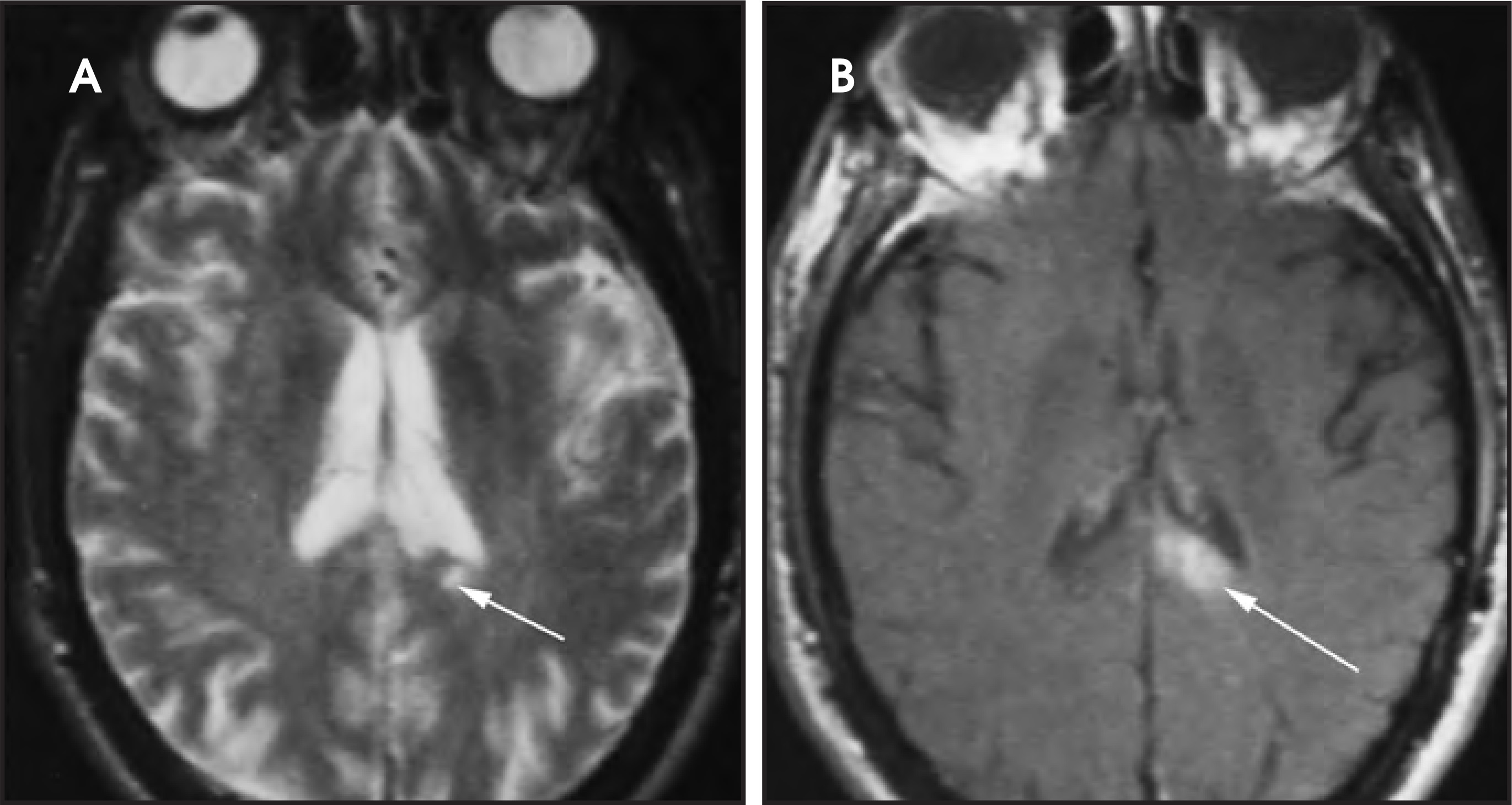 Figure 30.