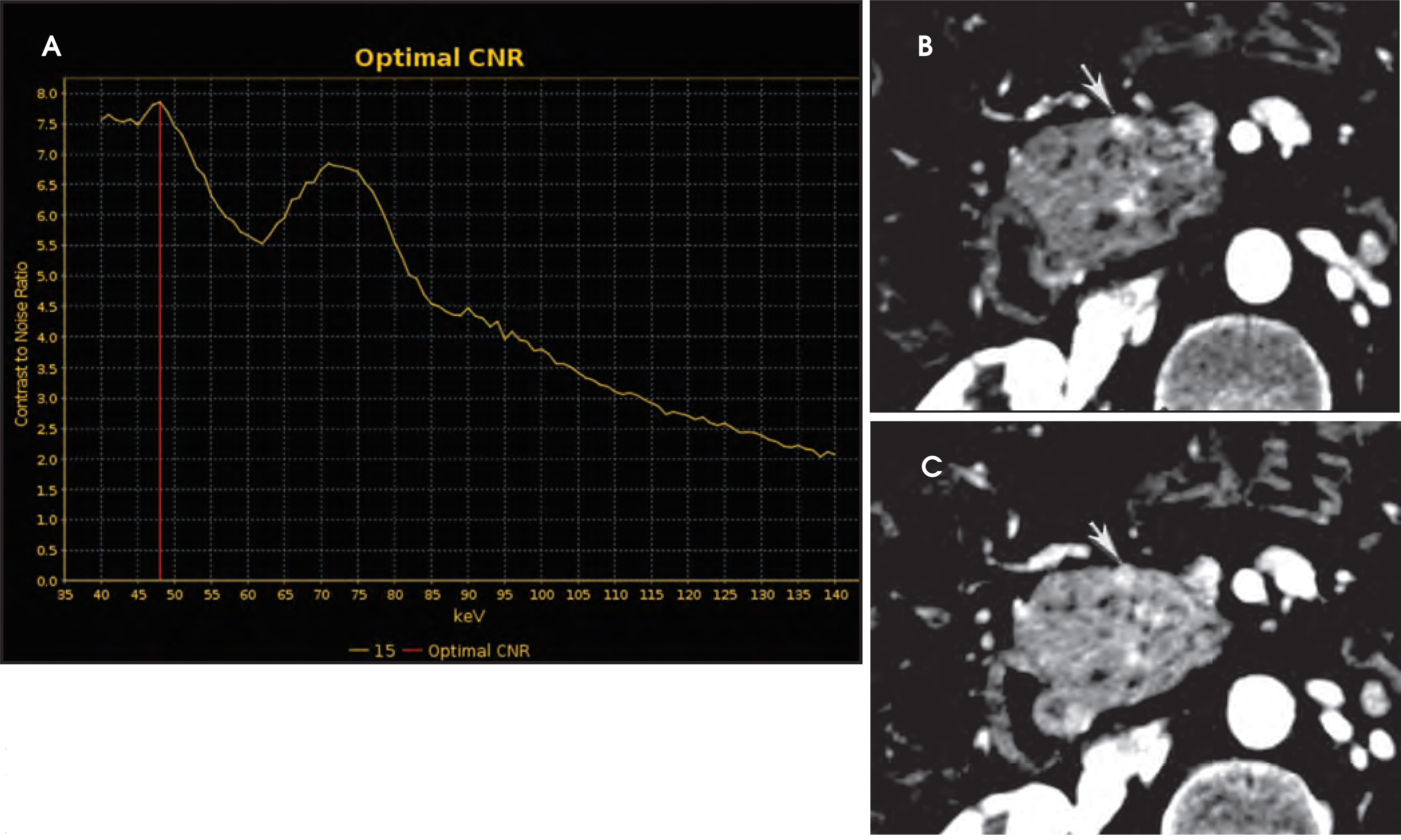 FIGURE 11.