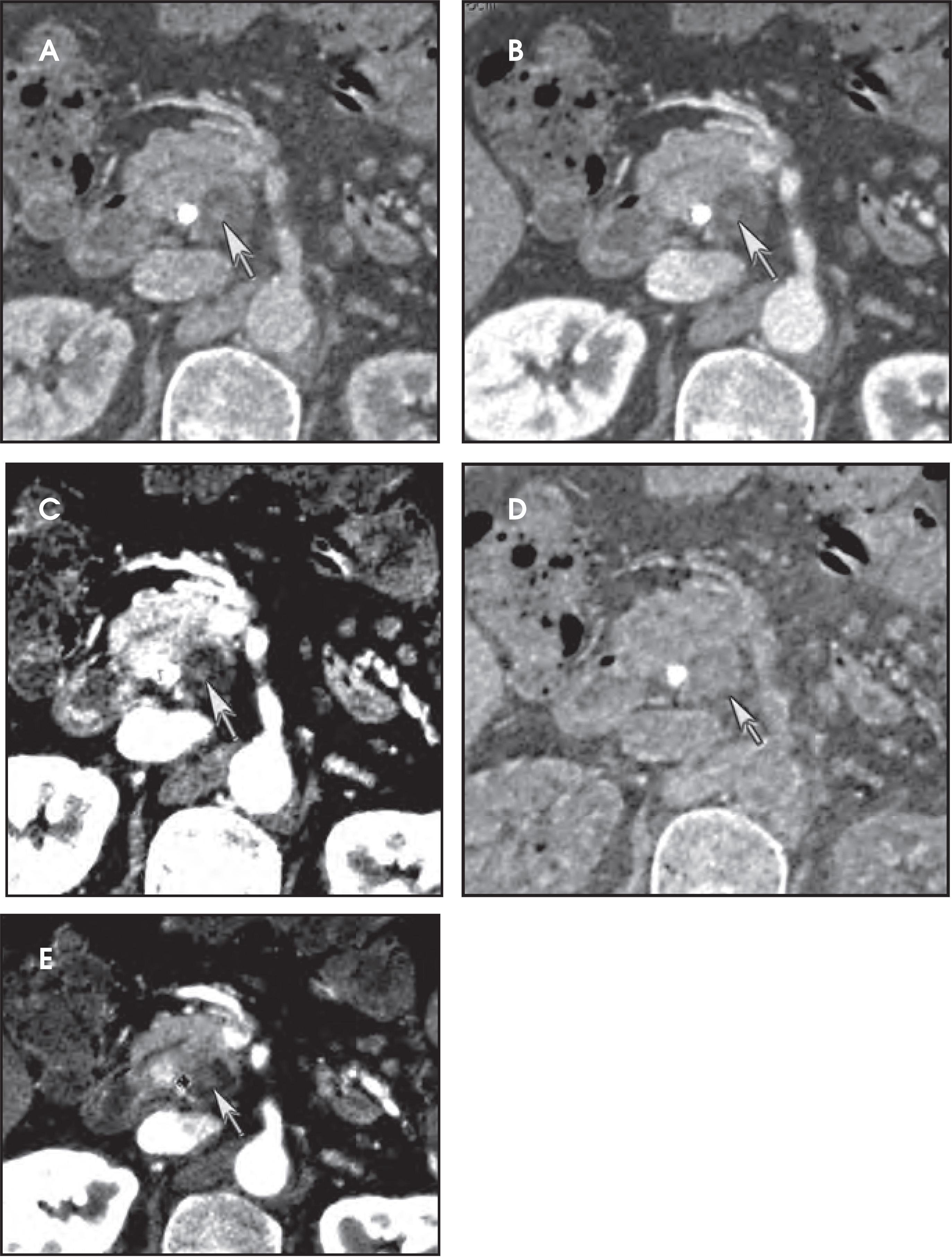 FIGURE 13.