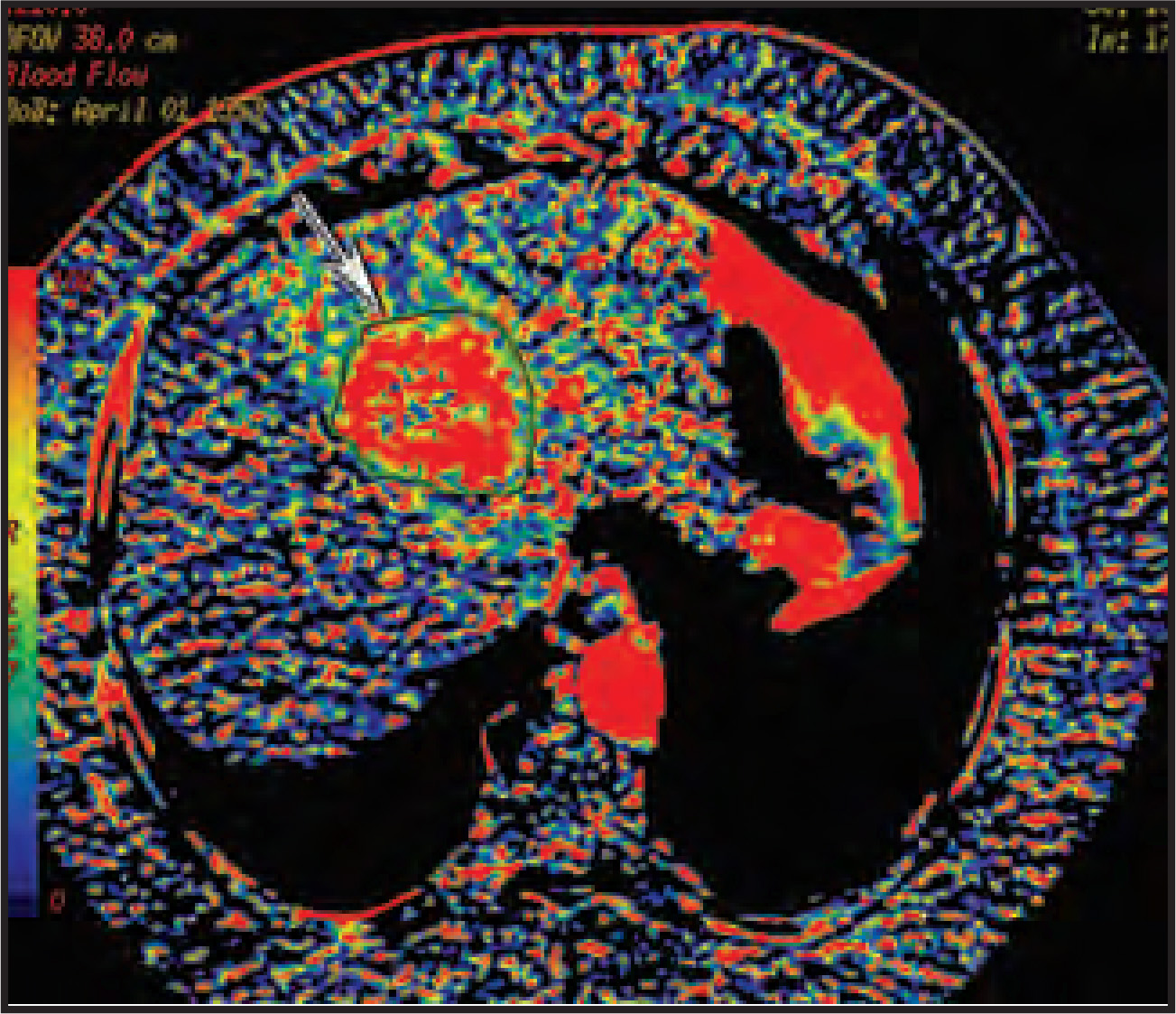 FIGURE 14.