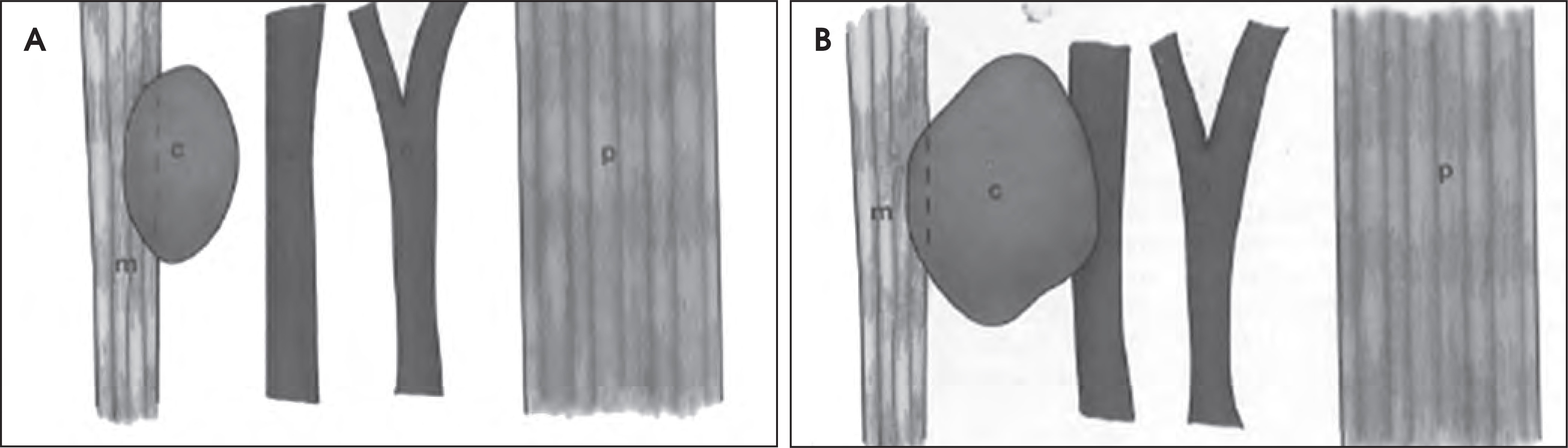 FIGURE 11.