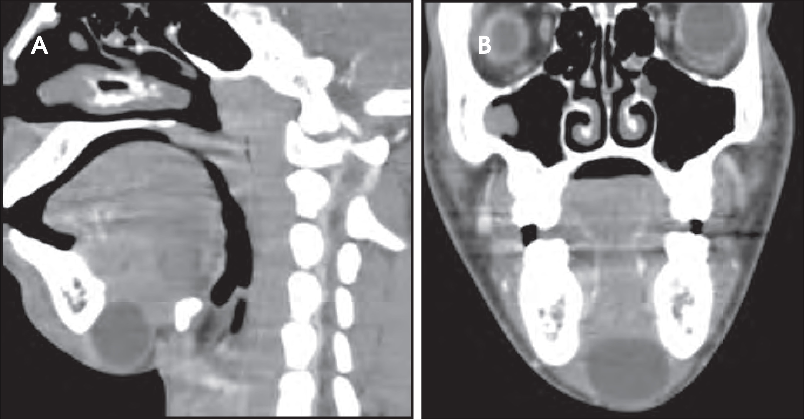 FIGURE 14.