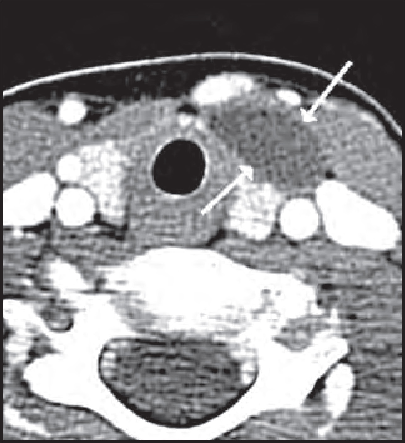FIGURE 15.