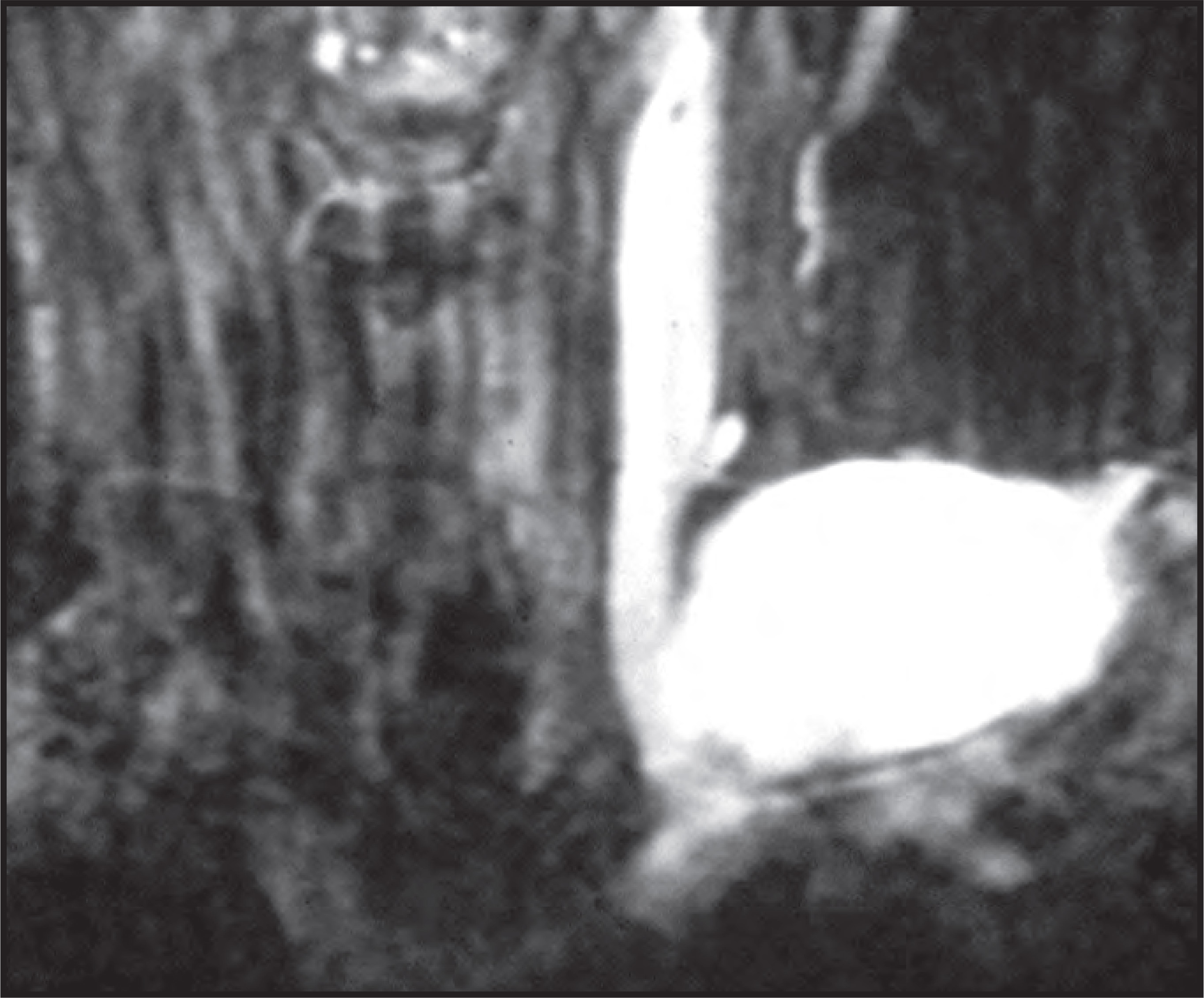 FIGURE 17.
