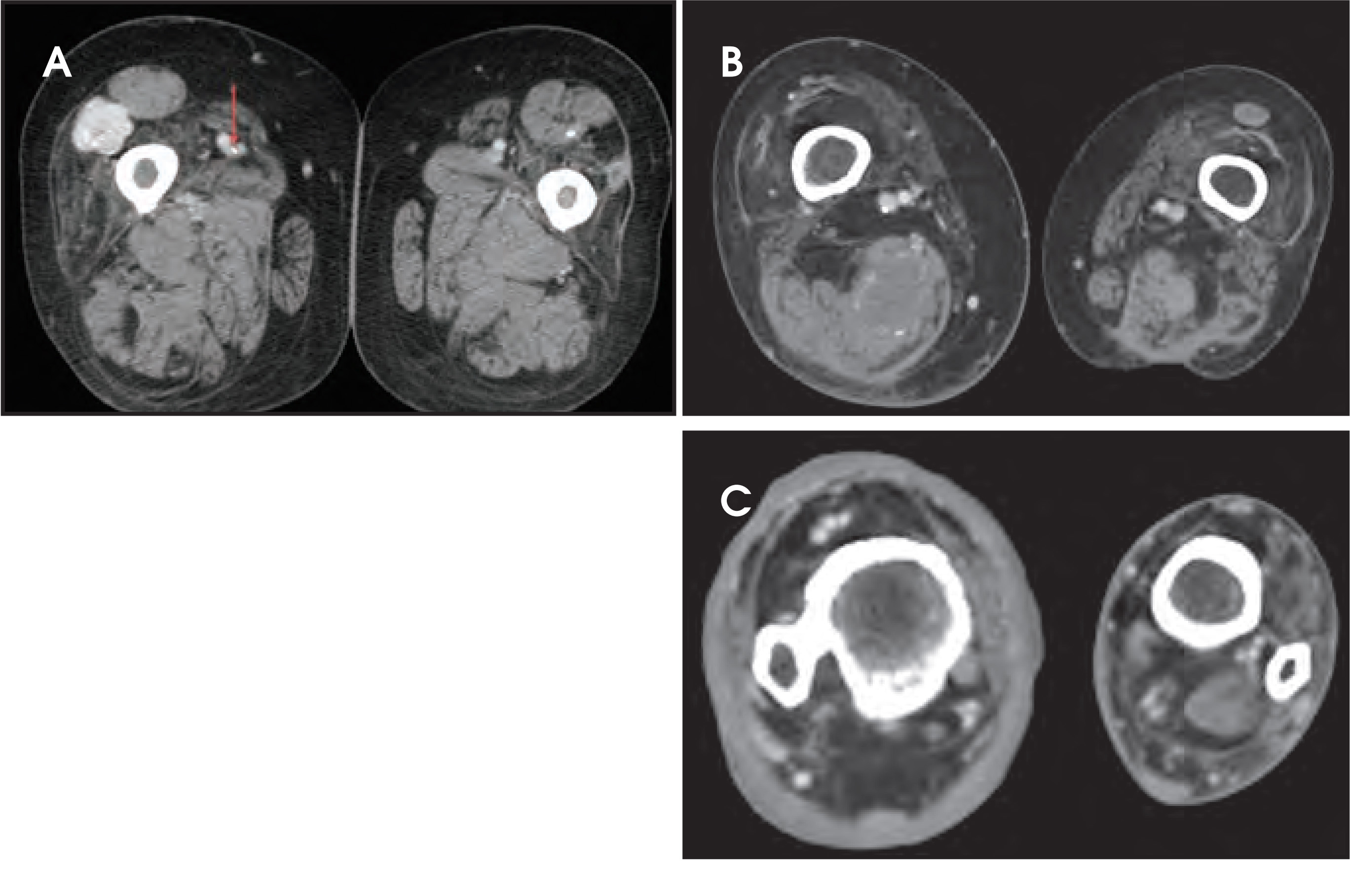 FIGURE 11.