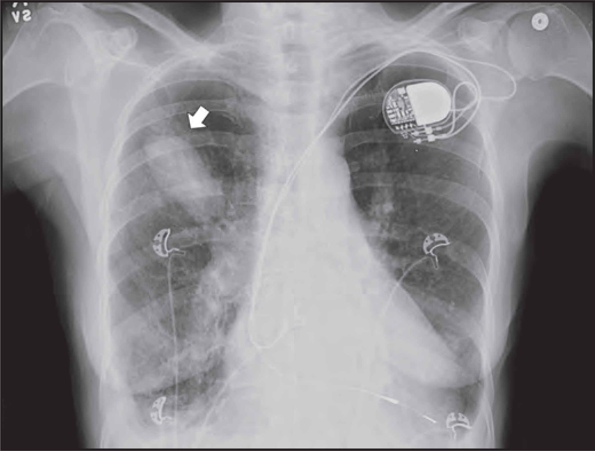 FIGURE 4.