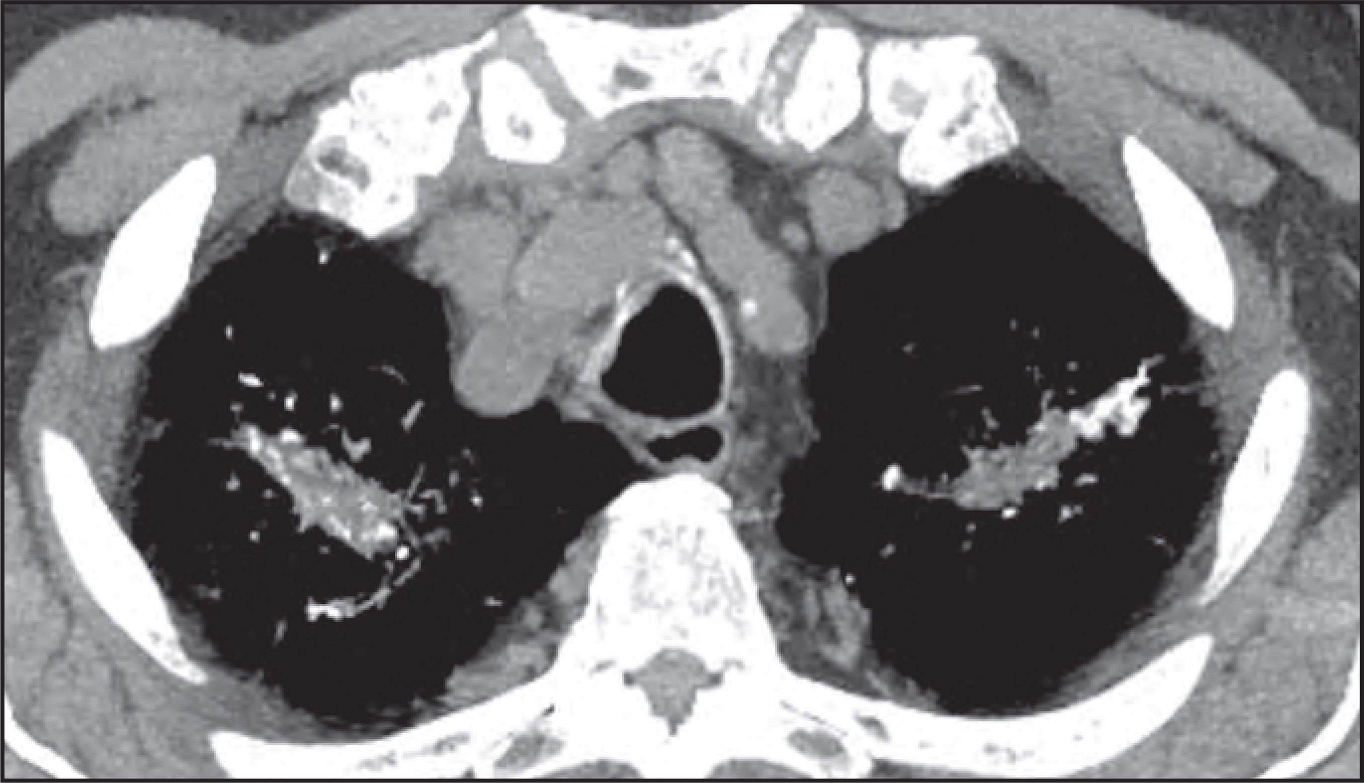 FIGURE 11.