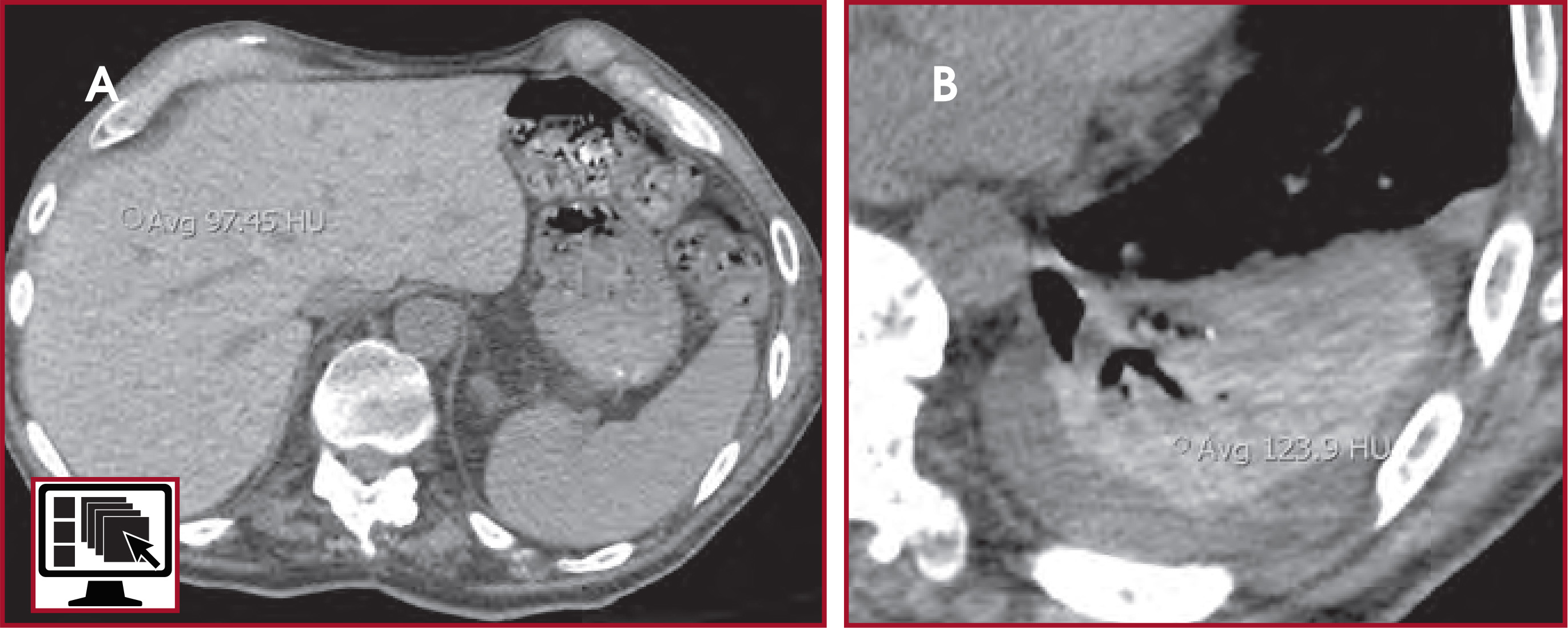 FIGURE 12.
