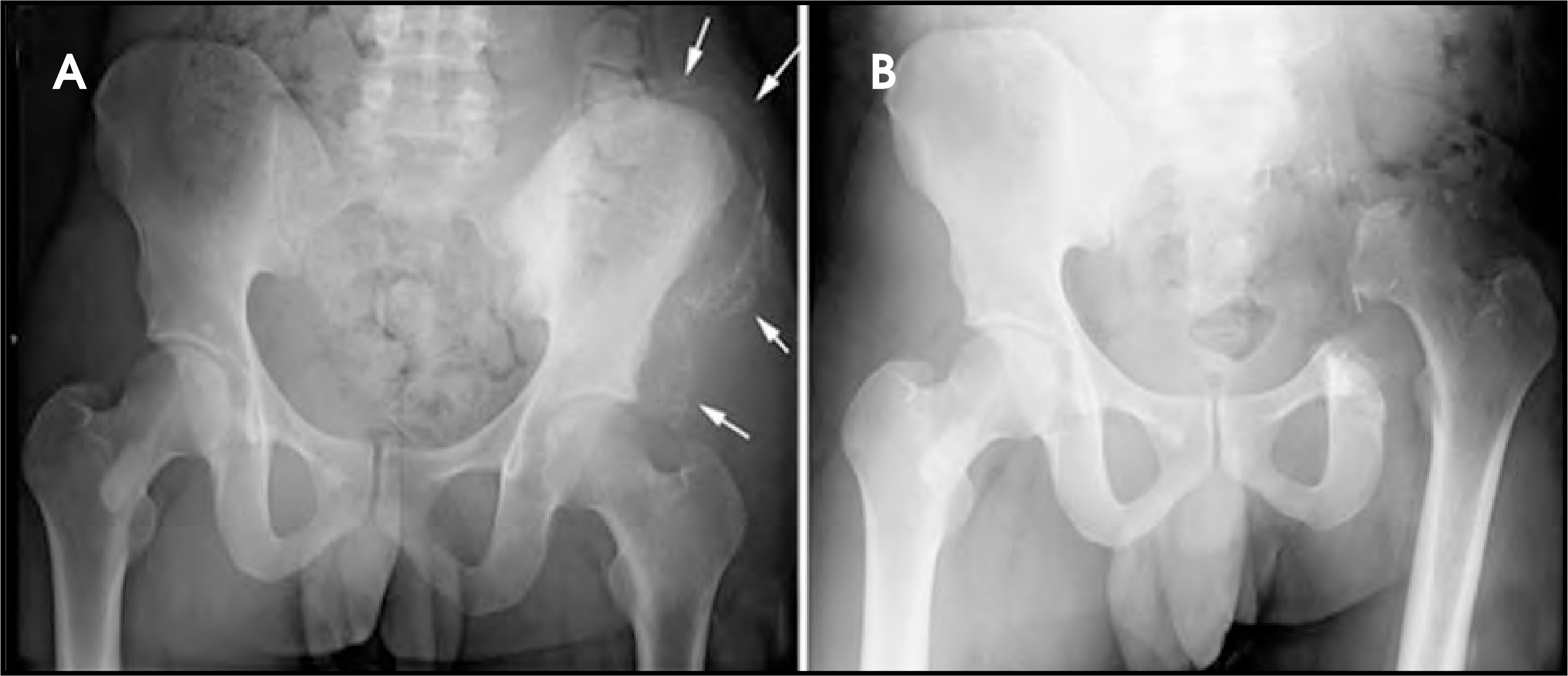 FIGURE 5.